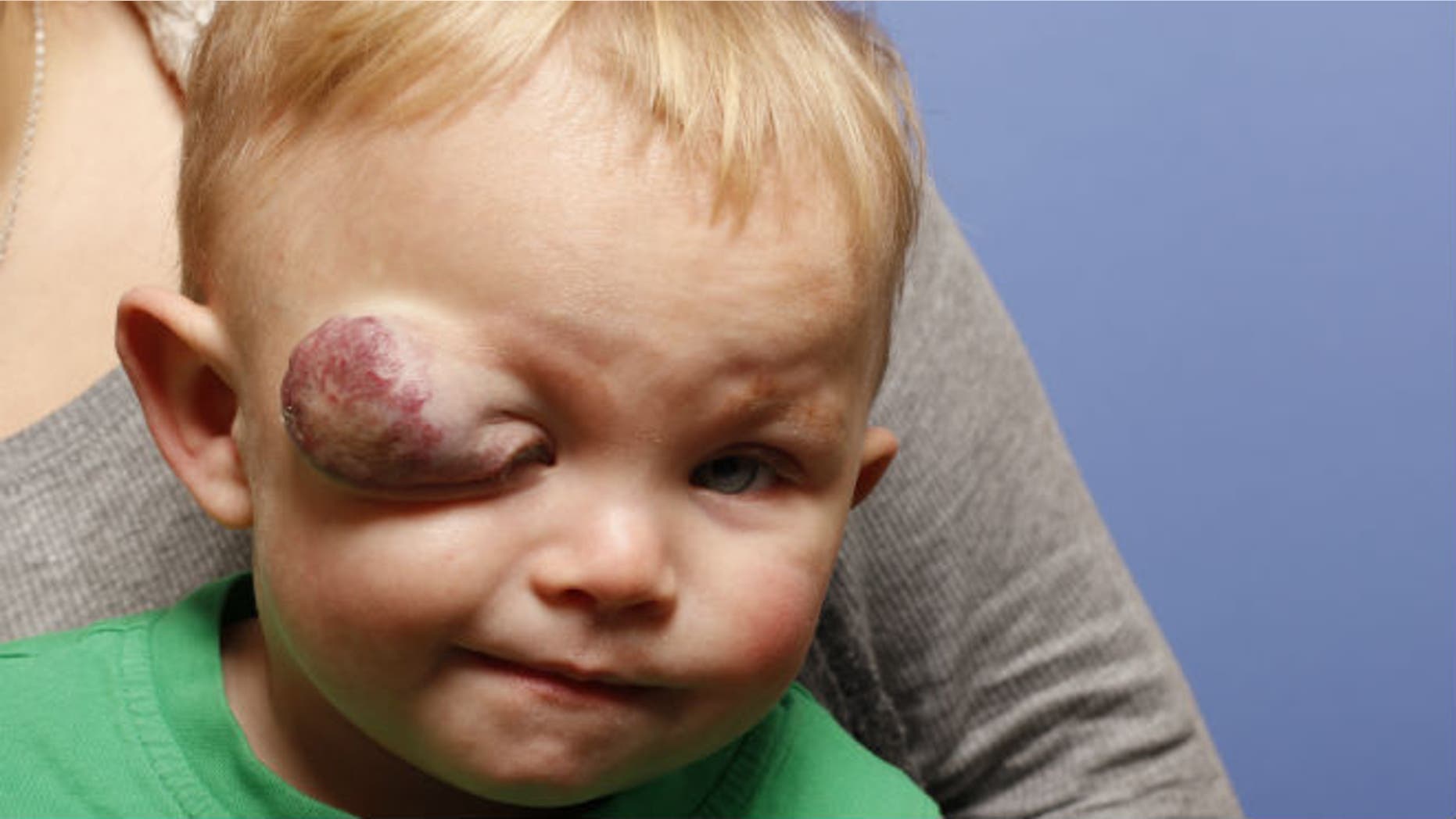 Colby Ramos-Francis on Feb. 3, 2015. Image courtesy Little Baby Face Foundation.