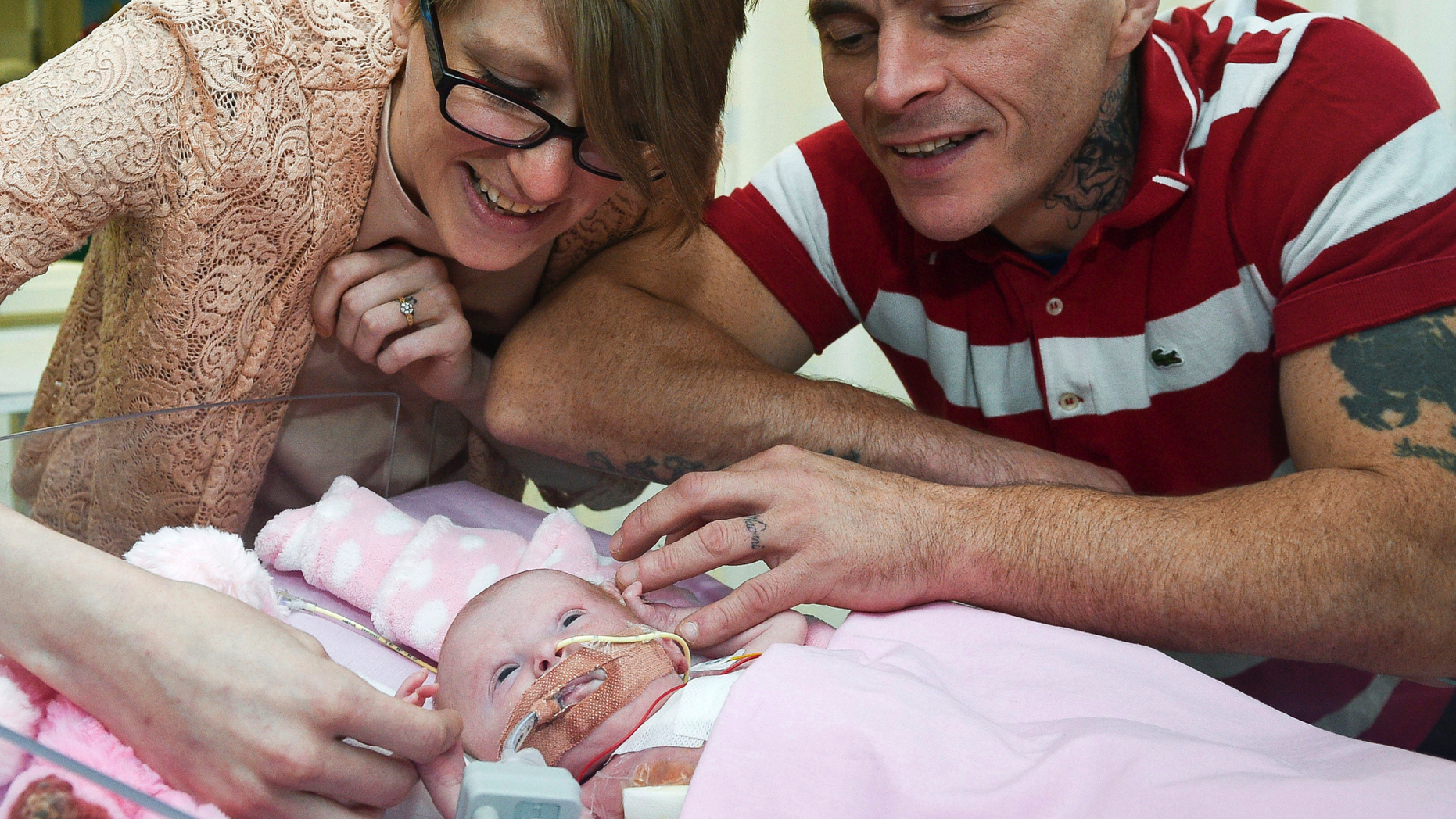 Naomi Findlay and Dean Wilkins, look at their daughter, three-week-old Vanellope Hope Wilkins who was born with an extremely rare condition in which the heart grows on the outside of the body, at Glenfield Hospital in Leicester.