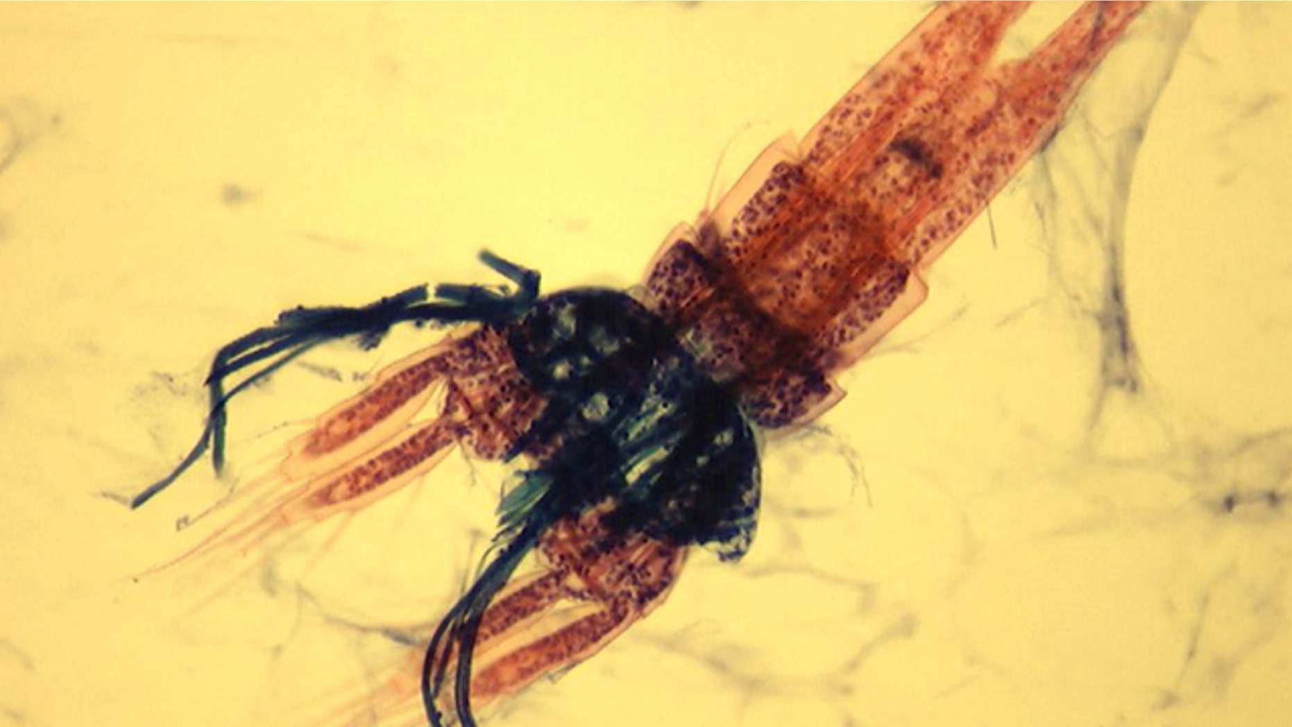 Copepods like this one are in every glass of New York city tap water -- and that's nothing to worry about.