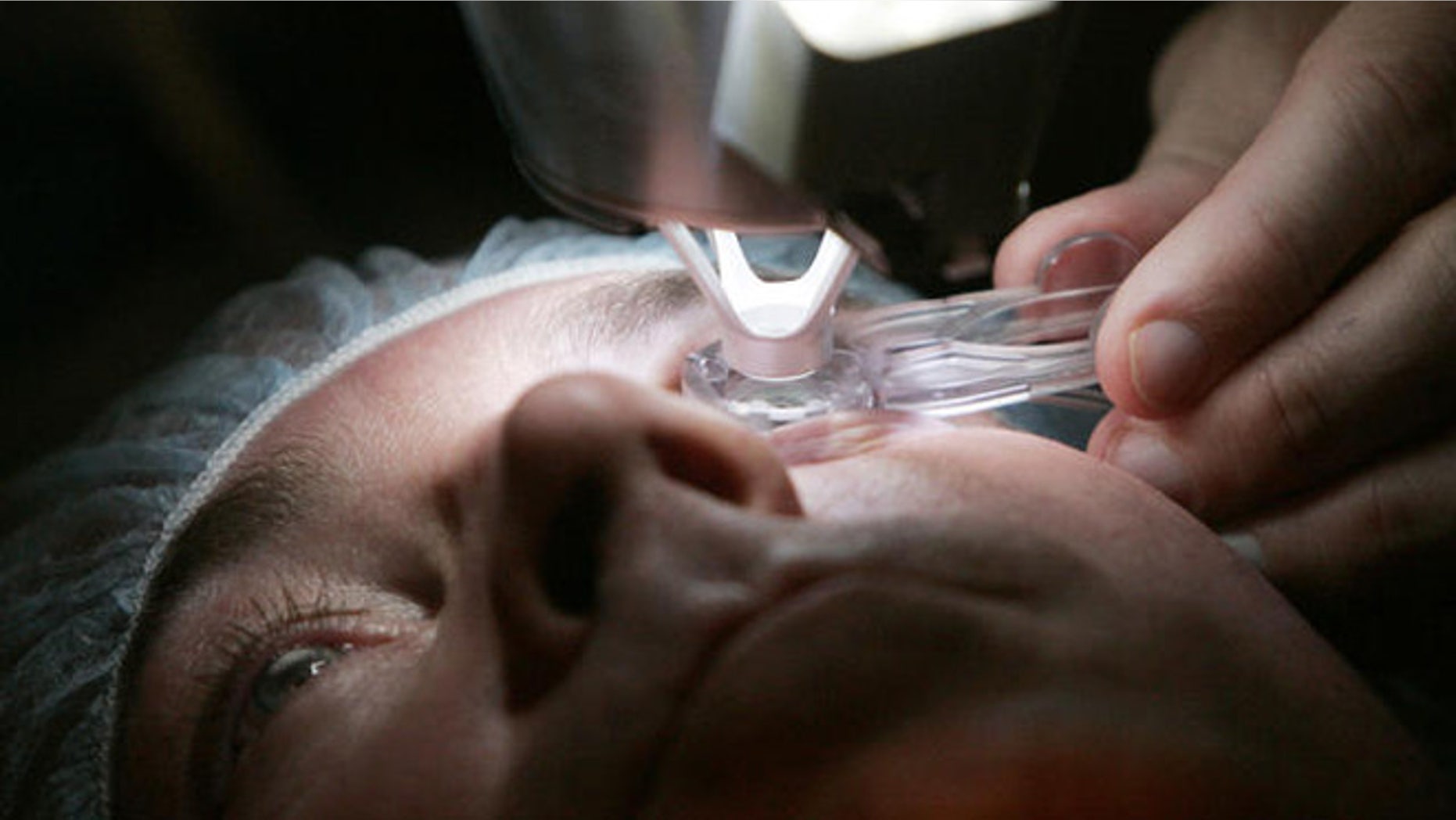 ** ADVANCE FOR SUNDAY, DEC. 11 **Dr. Colman Kraff docks the femtosecond laser, flattening the cornea, of patient Steve Parker as the initial step in creating the Lasik flap during Parker's eye surgery at Kraff's offices in Chicago Nov. 1, 2005. (AP Photo/Charles Rex Arbogast)