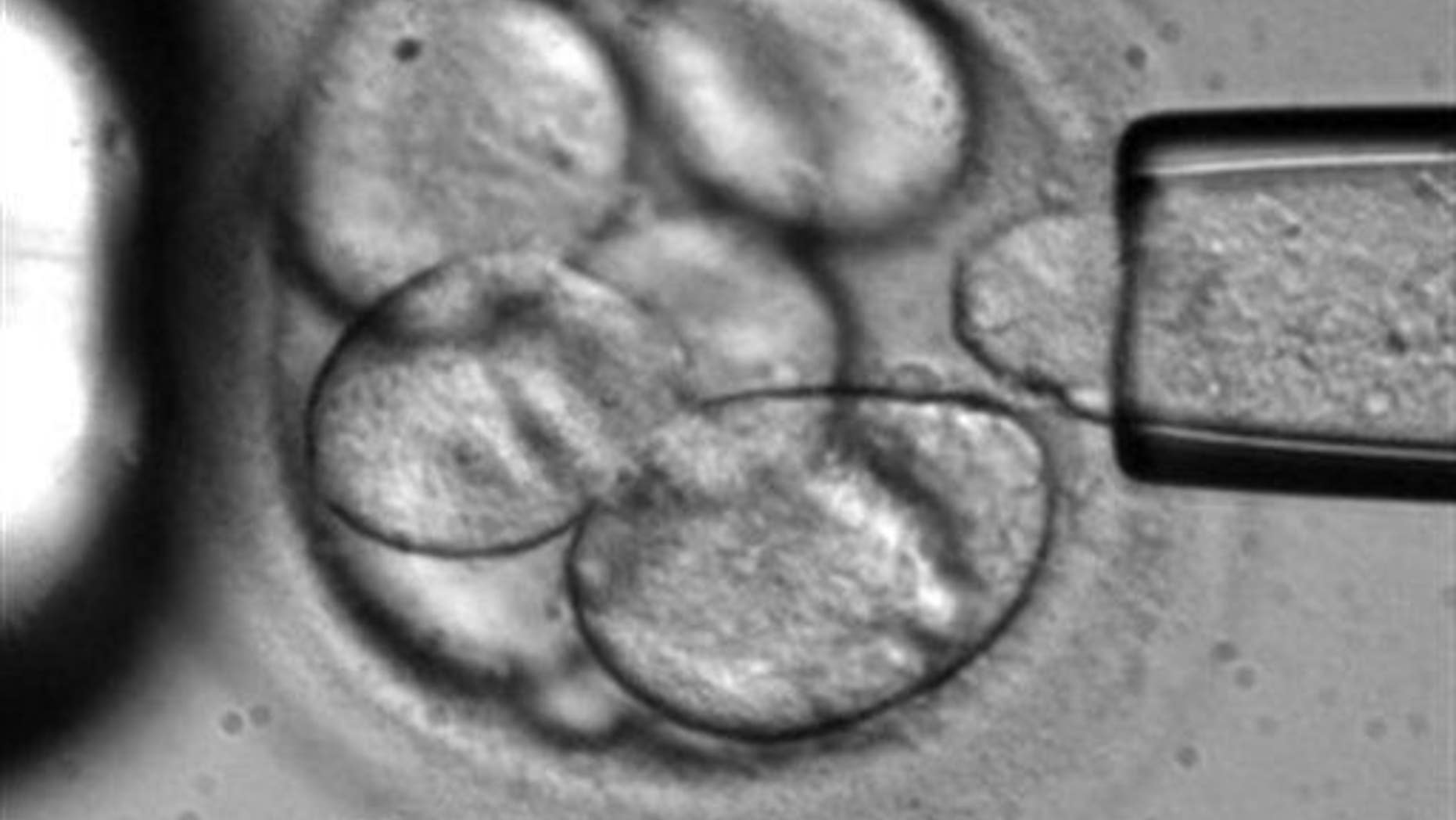 A file photo of a human embryo.