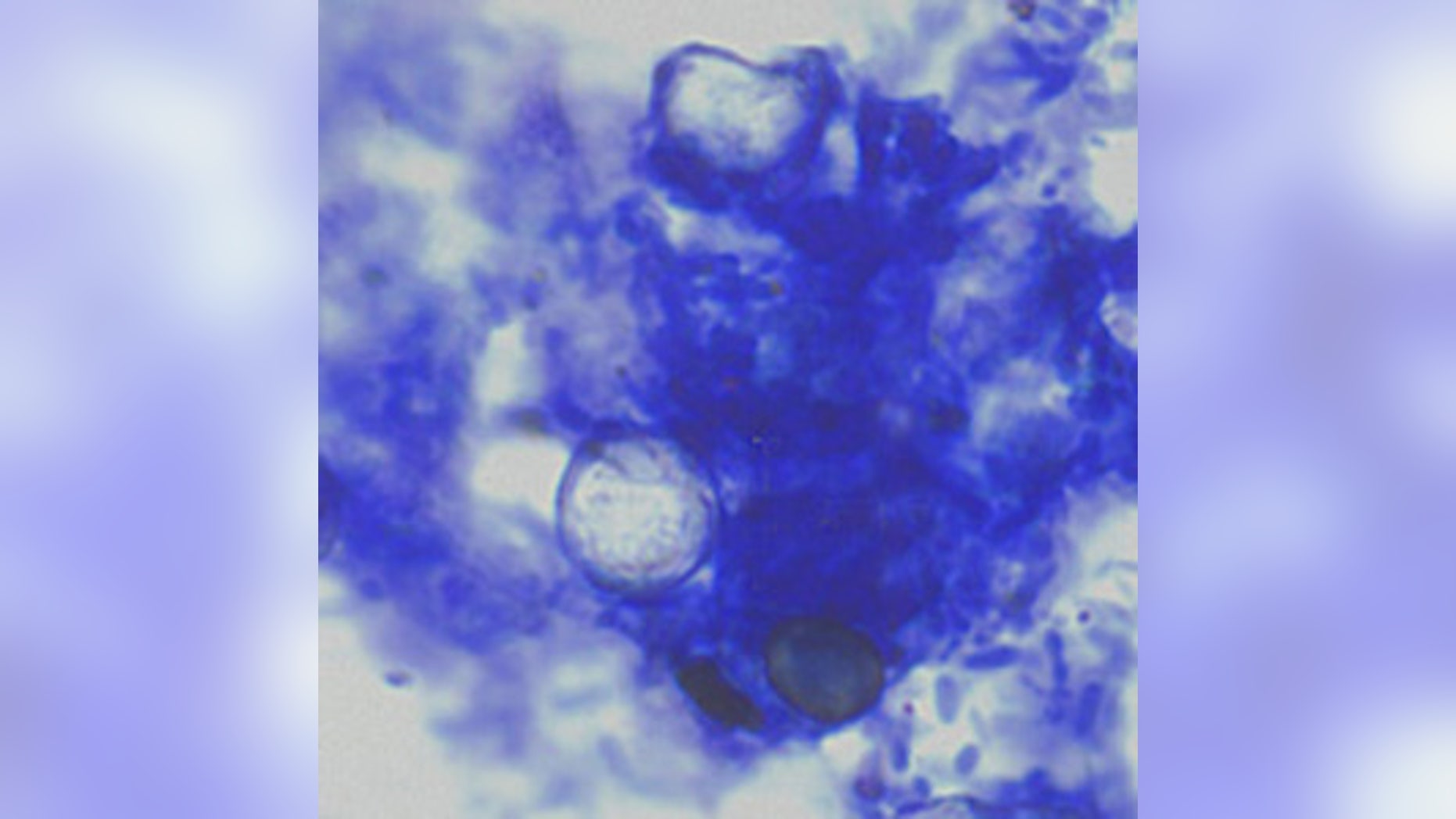 Oocysts of Cyclospora cayetanensis stained with modified acid-fast stain.