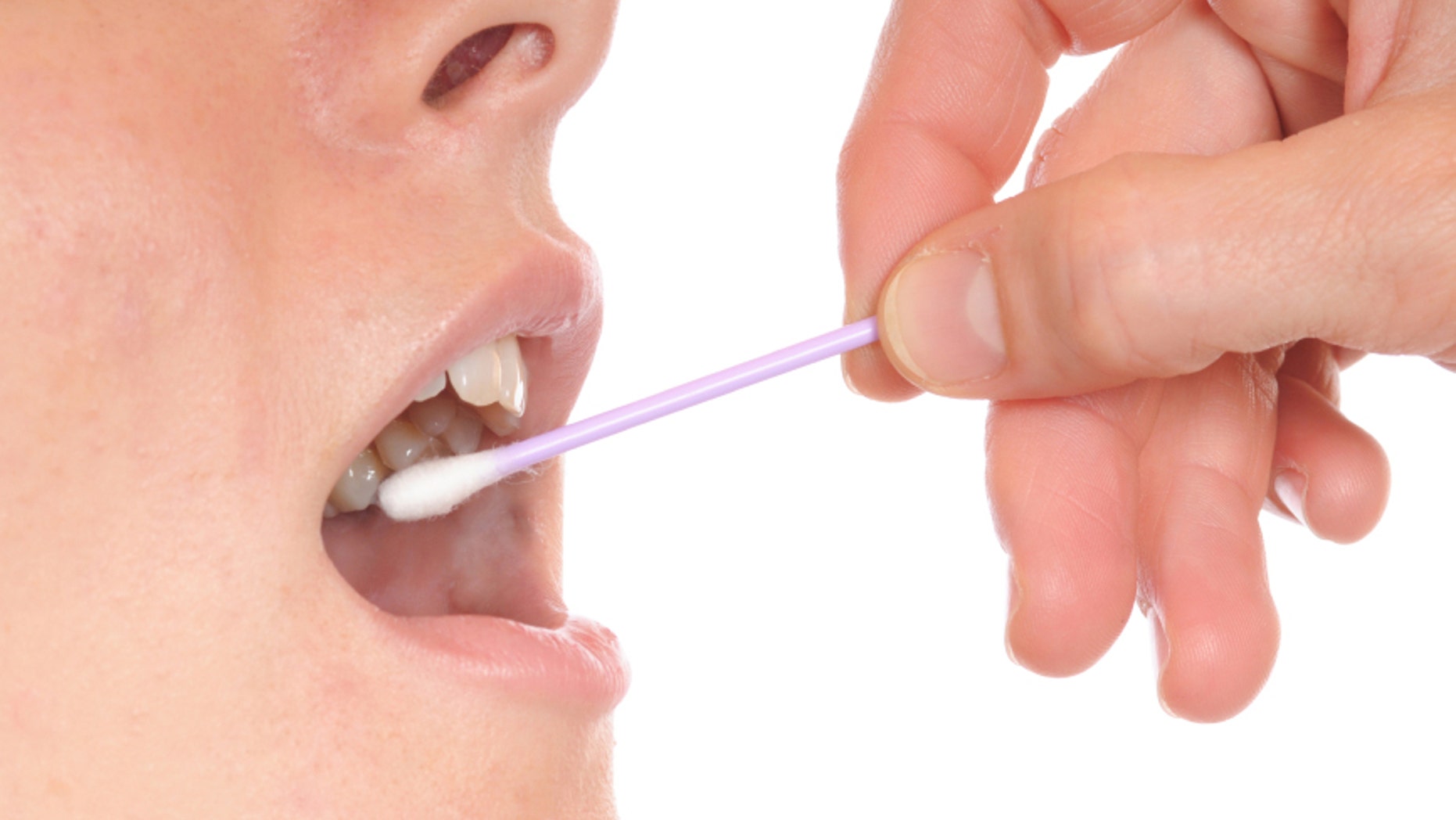 DNA-Entnahme bei einer weiblichen Patientin / DNA-Test from a human mouth