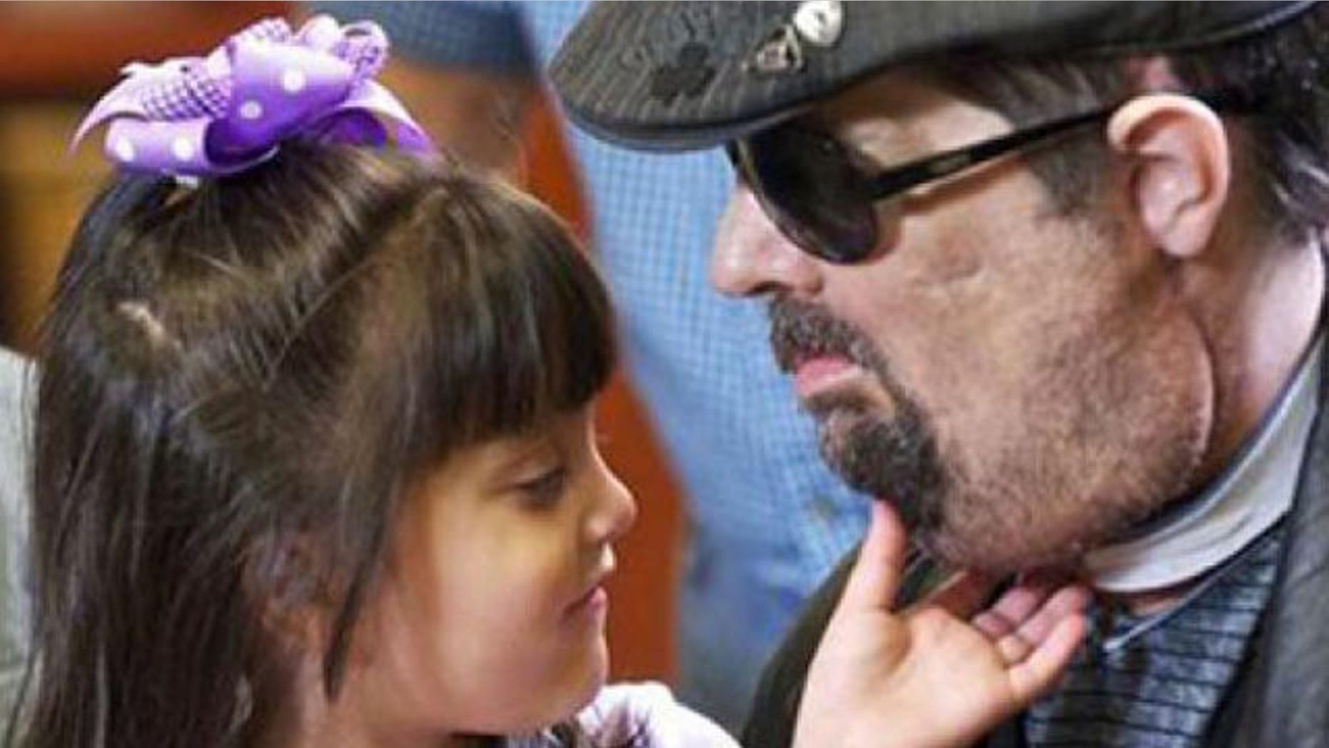 Full face transplant patient Dallas Wiens is seen with his 4-year old daughter Scarlette in this undated handout image.