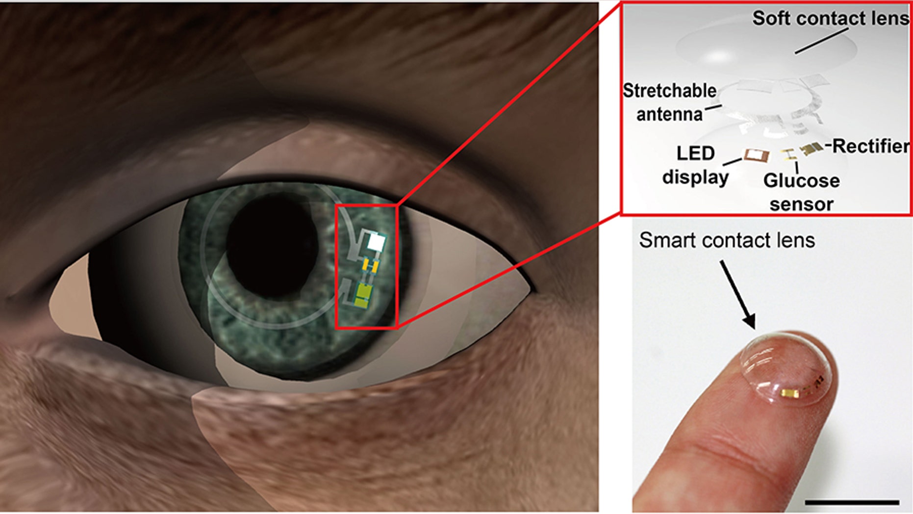 Scientists have developed a soft contact lens that will allow diabetics to monitor glucose levels in their tears.