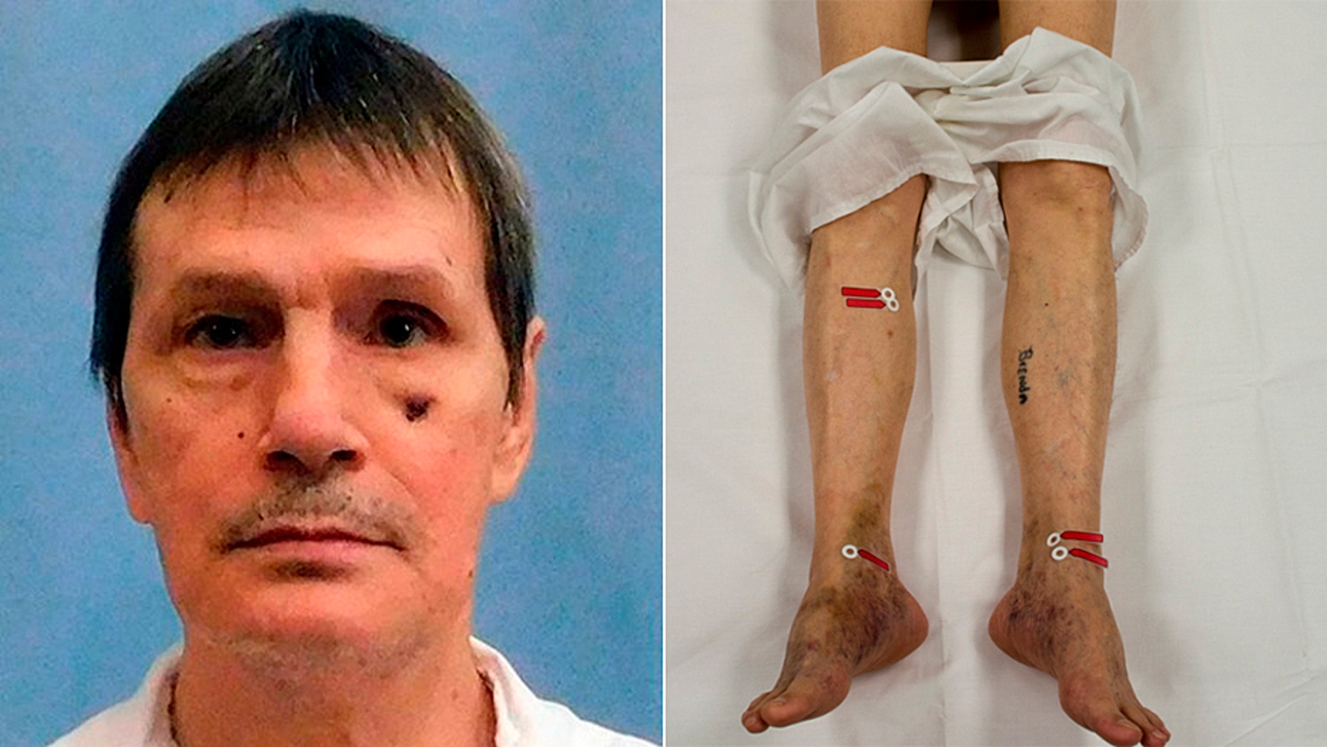Doyle Lee Hamm has argued his veins were too damaged for lethal injection. His execution was halted late Thursday when medical staff didn't think they had time to connect an intravenous line by the time a death warrant expired.
