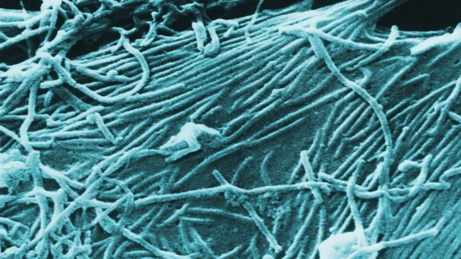 A scanning electron micrograph of the Ebola virus.