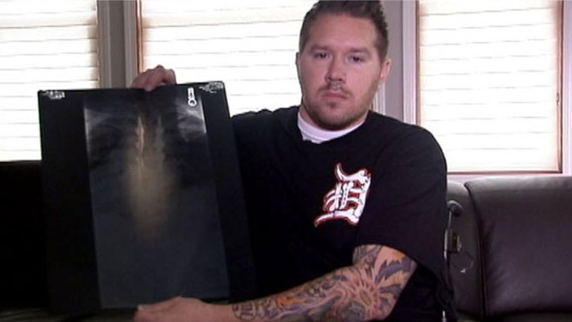 Brendan Milewski was injured in a Detroit fire. Now he says the city will cut his health benefits.
