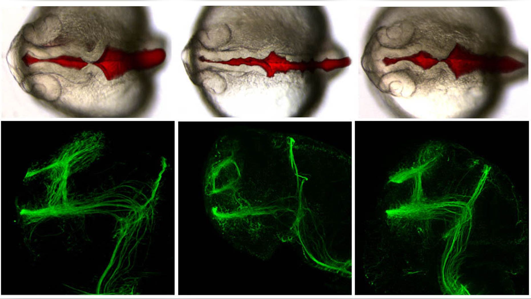 The control (left) shows no brain abnormalities in fish compared to when the autism-associated genes are repressed (center). The last picture shows a re-healed brain after human mRNA is added.