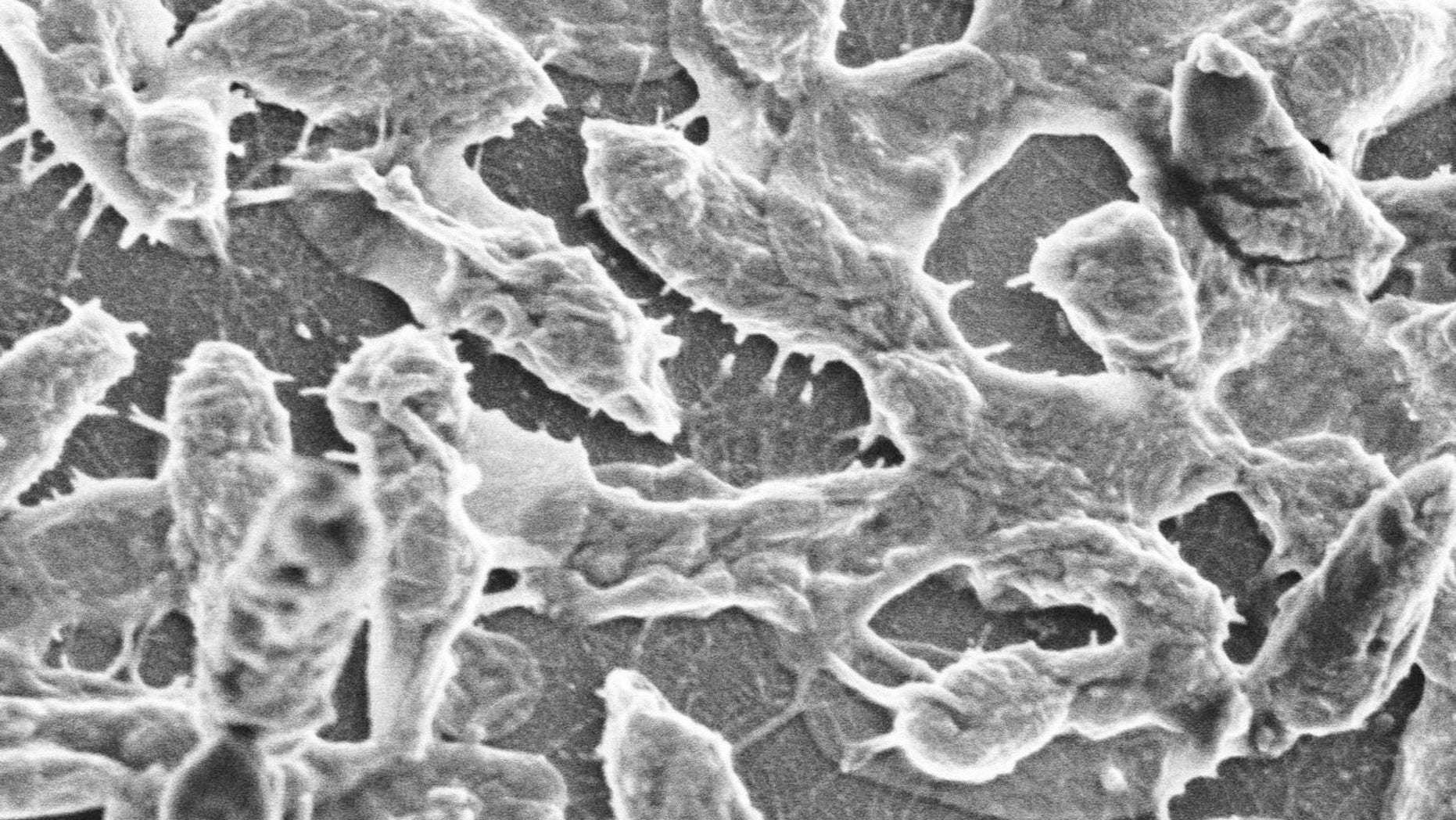 This image provided by UTMB-Galveston shows a scanning electron microscopic image of WT (wild type) Aeromonas hydrophila strain SSU, the bacteria responsible for the flesh-eating disease that is usually caused by a strep germ. Georgia grad student Aimee Copeland is fighting a life-threatening flesh-eating disease, and doctors are calling her case very rare. The infection occurred after she gashed her leg in a Georgia river May 1, 2012, after a zip line accident. (AP Photo/UTMB-Galveston, Ashok K. Chopra, Ph.D., and Dr. Leon Bromberg)