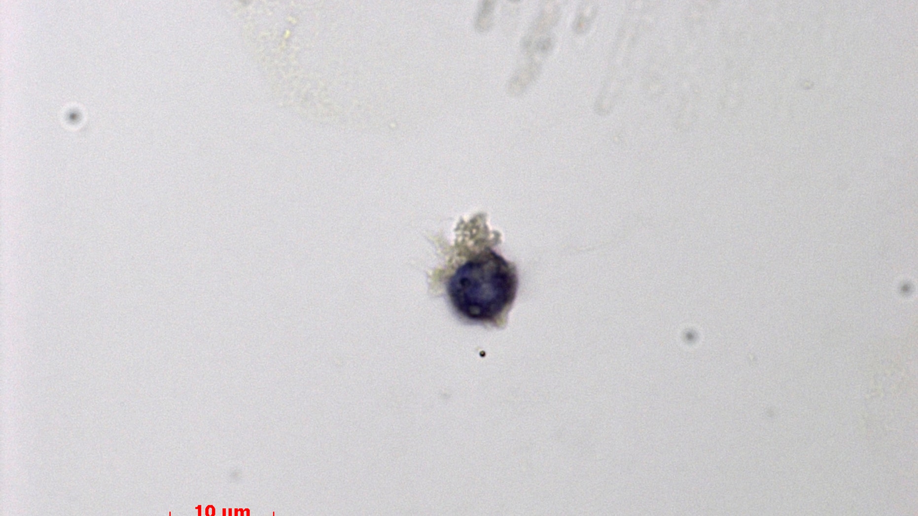 Sept. 17, 2015: This photo provided by the the National Center of Scientific Research (CNRS) shows a human round spermatid.