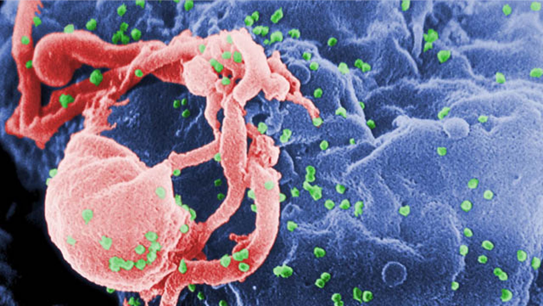 (Cynthia Goldsmith/Centers for Disease Control and Prevention via AP)