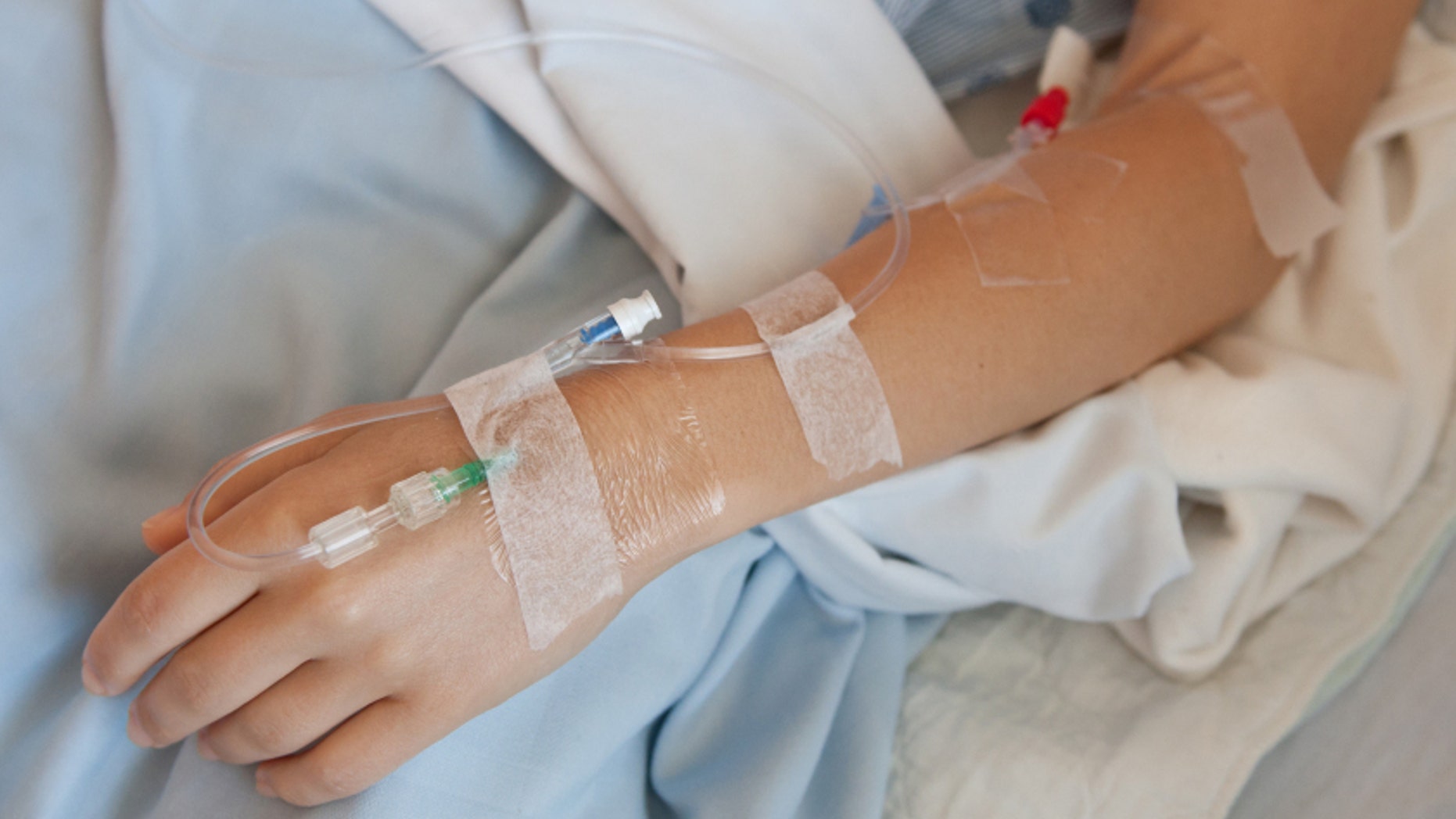 Woman in a hosptial with an IV drip in her hand and arm.