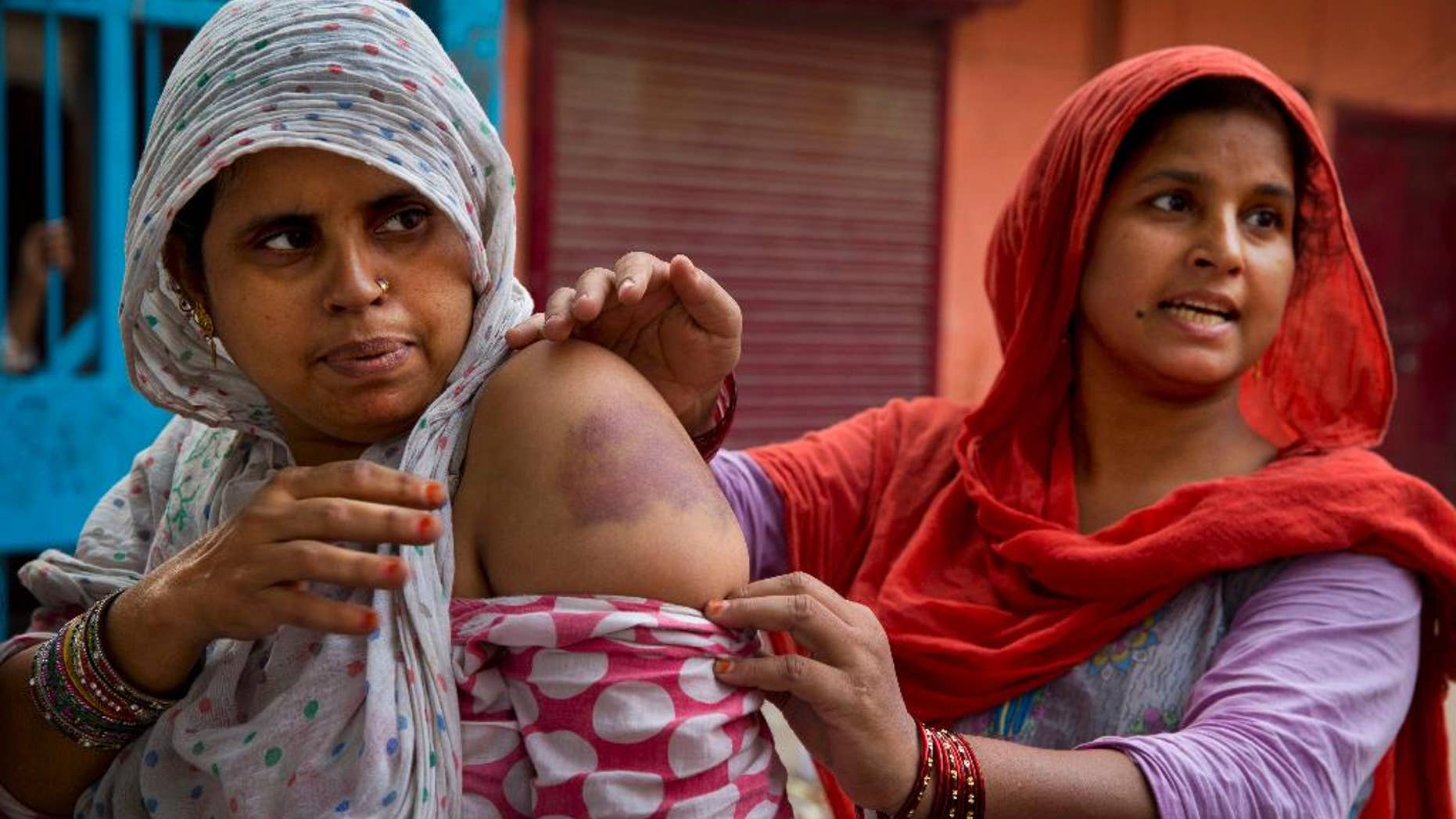Nov. 7, 2014: Bhuri Begum, right, pulls down the sleeve of Farhad's shirt to display bruises caused allegedly by police beating after security was enhanced in the area following rioting between Hindus and Muslims in New Delhi