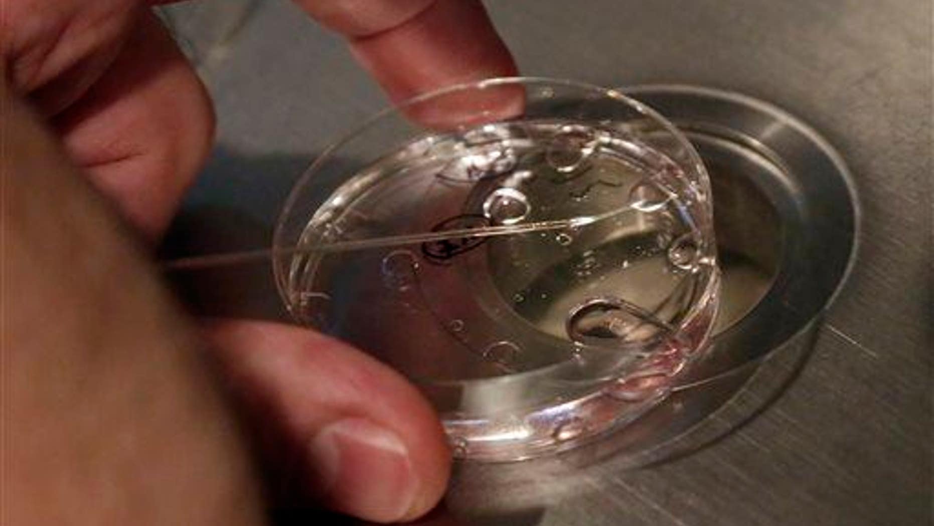 File photo of a nonviable embryo.