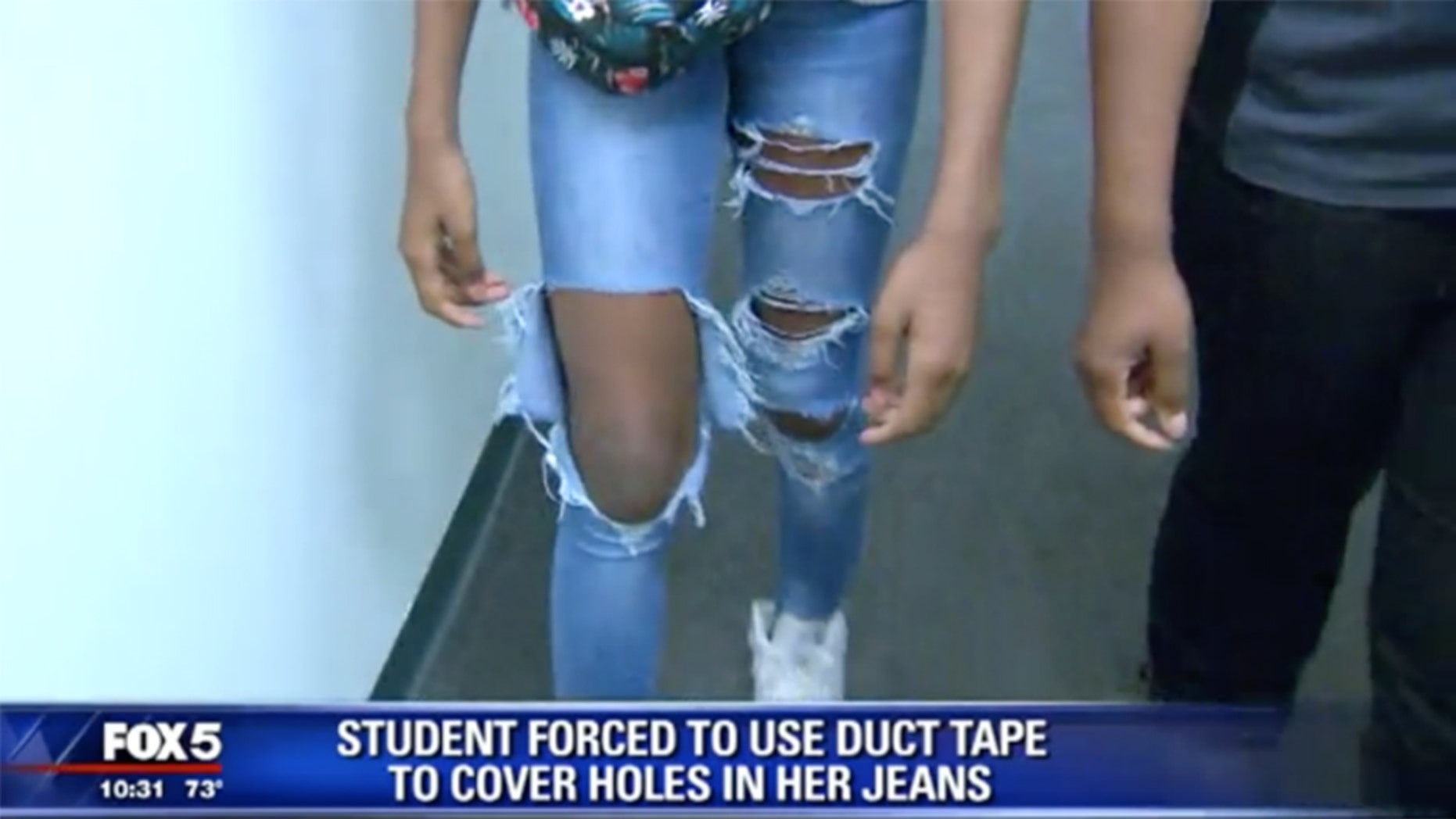 Mom Angry School Forced Daughter To Cover Legs With Duct Tape For