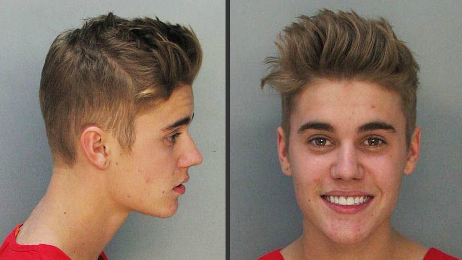 Prison ‘breakout’: Explaining Justin Bieber’s acne in his mug shot | Fox News