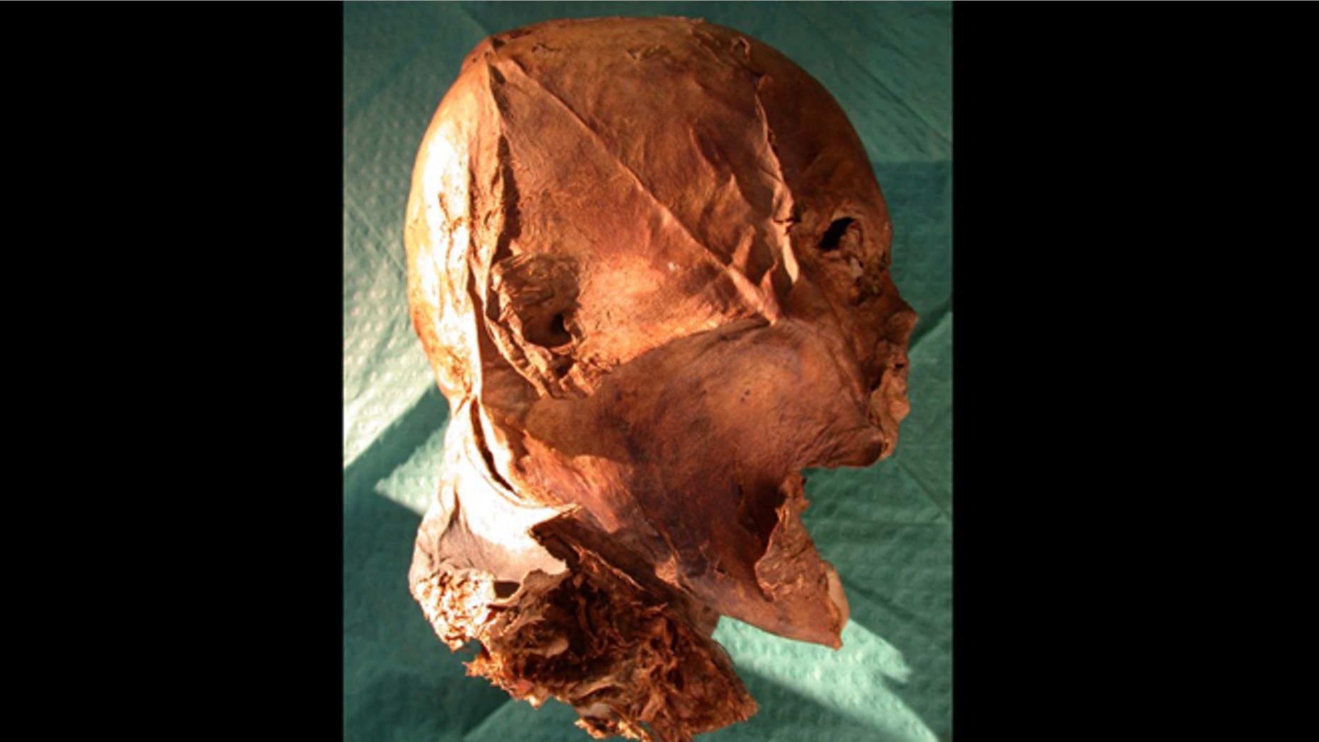 French King Henry IV's embalmed head -- or is it?