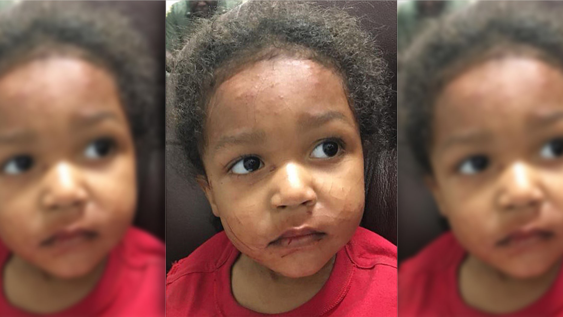 Kylen Holliman is being heralded a "hero" for climbing out of the car after it wrecked, killing his mother, and getting attention. He and his 1-year-old brother survived days without food or water in the Arkansas heat until they were discovered by authorities.