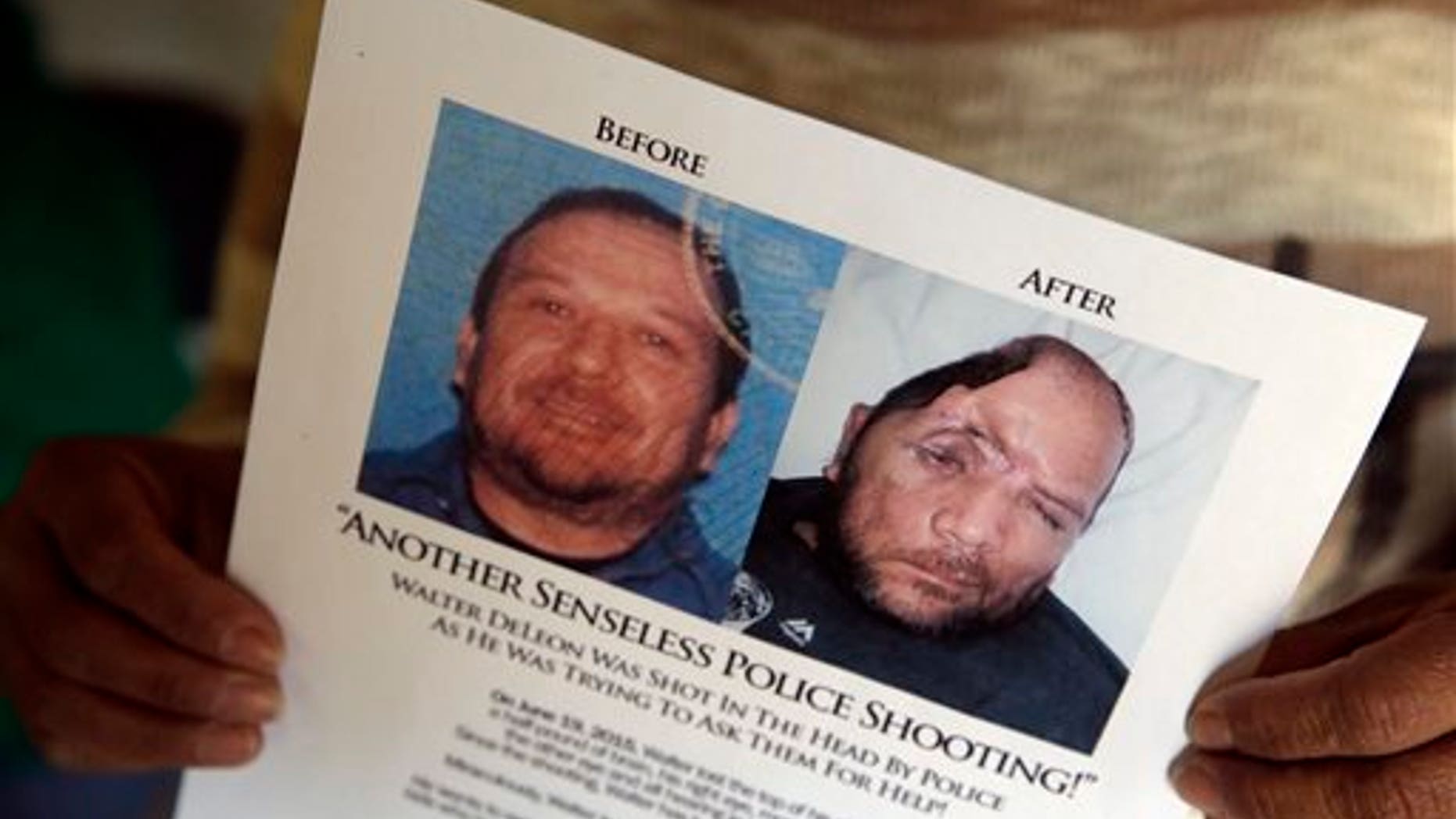 Yovanna DeLeon holds a flier with the details of her brother Walter's shooting last June on Wednesday, Dec. 2, 2015 in Covina, Calif. Walter DeLeon, who lost a quarter of his skull after being shot by a Los Angeles police officer, has filed notice that he plans to sue the city and police department. (AP Photo/Chris Carlson)