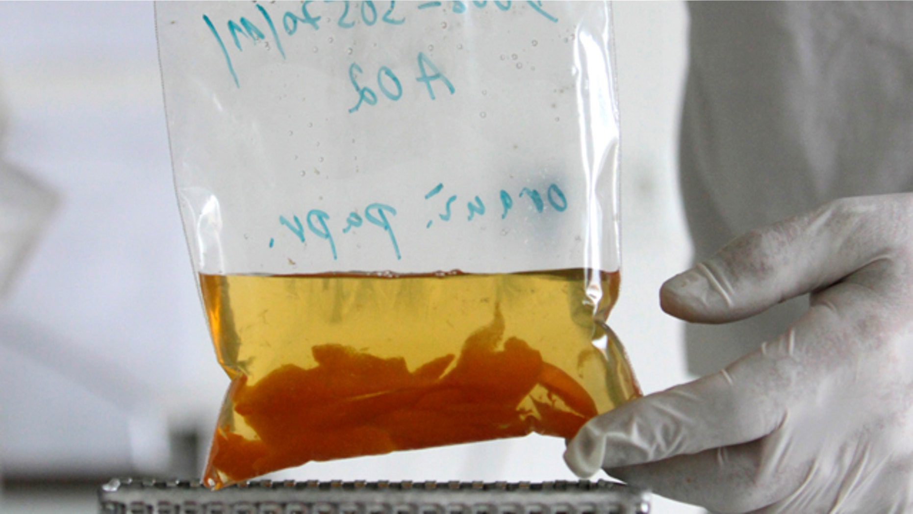 Lab testing for E. coli