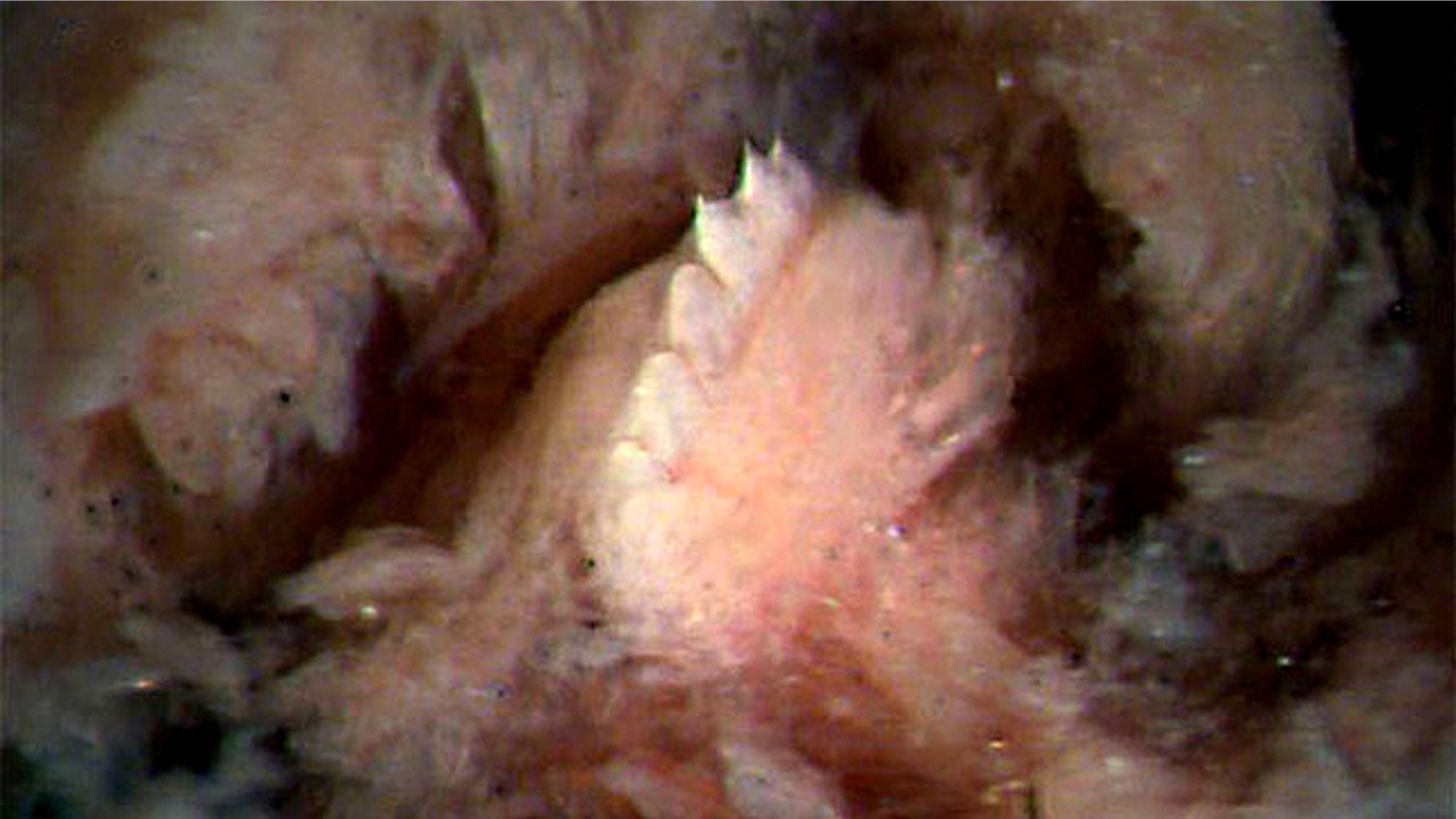The new leech species, Tyrannobdella rex, has only a single jaw with eight large teeth that are five times taller than those of other leeches.