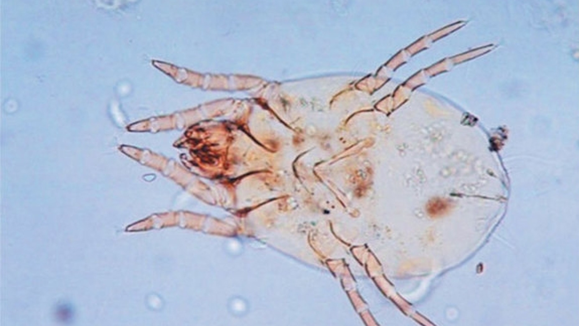 This photo shows a female mite of the species Dermatophagoides pteronyssinus. The New England Journal of Medicine ©2012