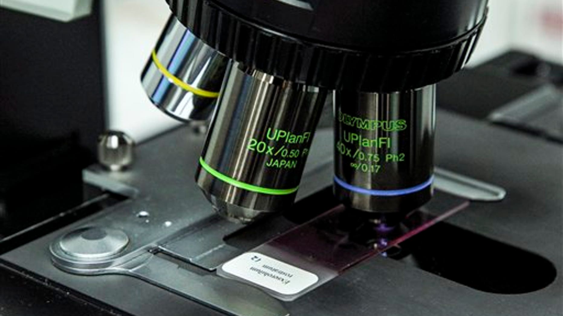 A close-up view of a microscope taking a look at a meningitis slide.