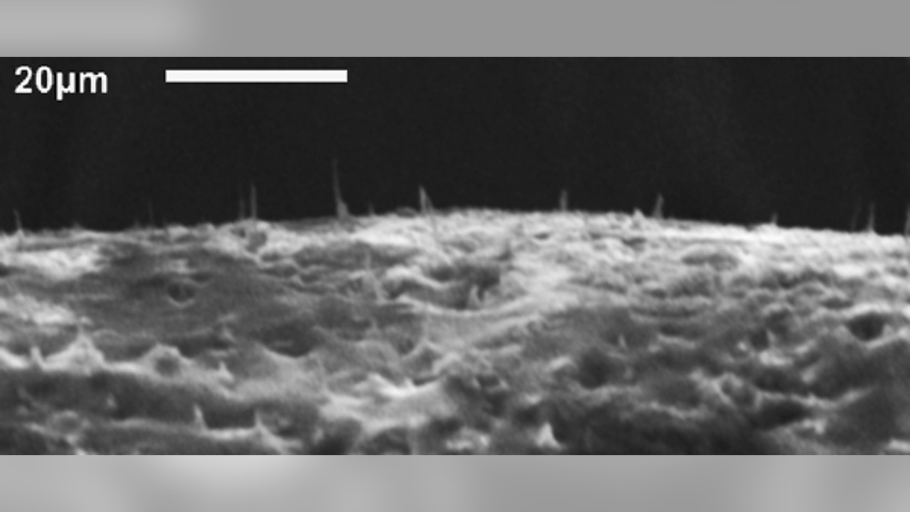 This image shows carbon nanofiber "needles" embedded in an elastic silicone membrane.