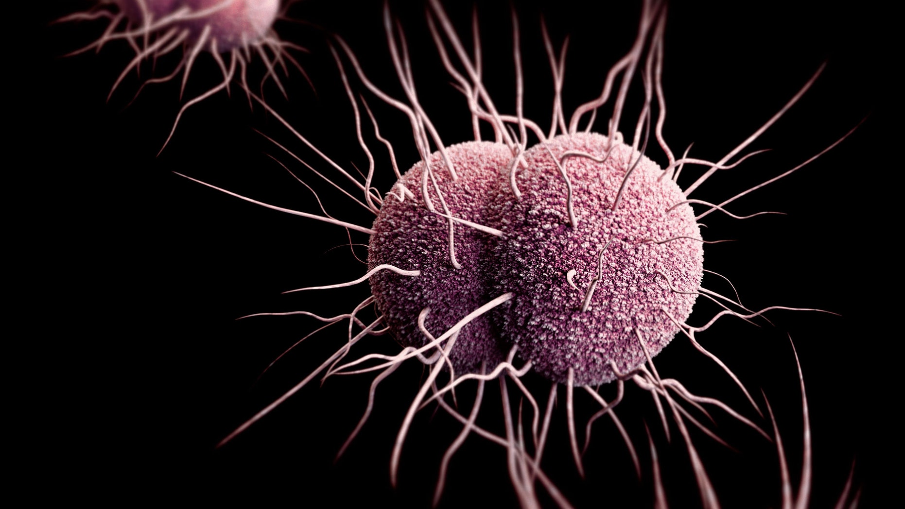 Antibiotic-resistant gonorrhea, shown here, spreads easily and symptoms are often missed. (CDC)
