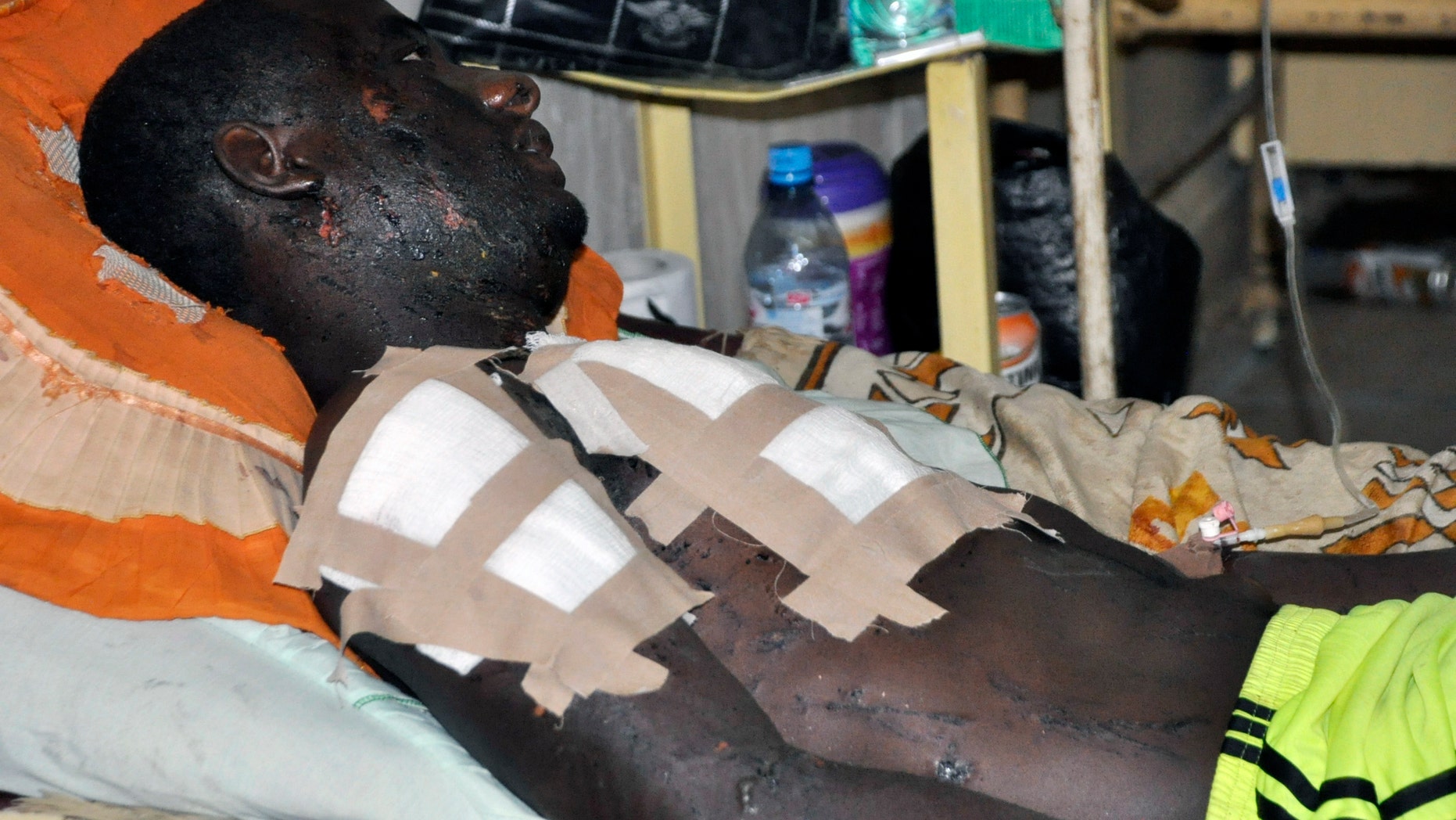 Nov. 30, 2014 - A victim of Friday's bomb explosion recuperates at the Murtala Muhammed specialist hospital, in Kano, Nigeria. More than 102 people were killed in the bomb explosions at the central mosque in the city Friday. Suspected Islamic extremists struck 2 state capitals in northeastern Nigeria Monday, with twin blasts at a crowded market and a police base.