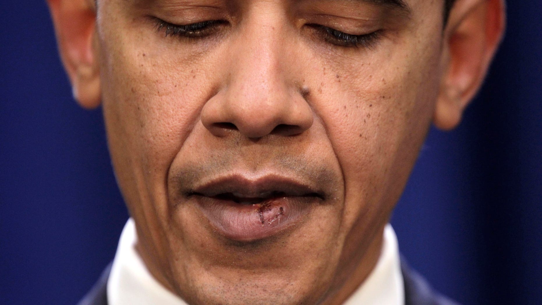Nov. 29: Stitches are seen in President Barack Obama's lower lip as he delivers a statement to members of the media in the Old Executive Office Building, on the White House campus in Washington, D.C.