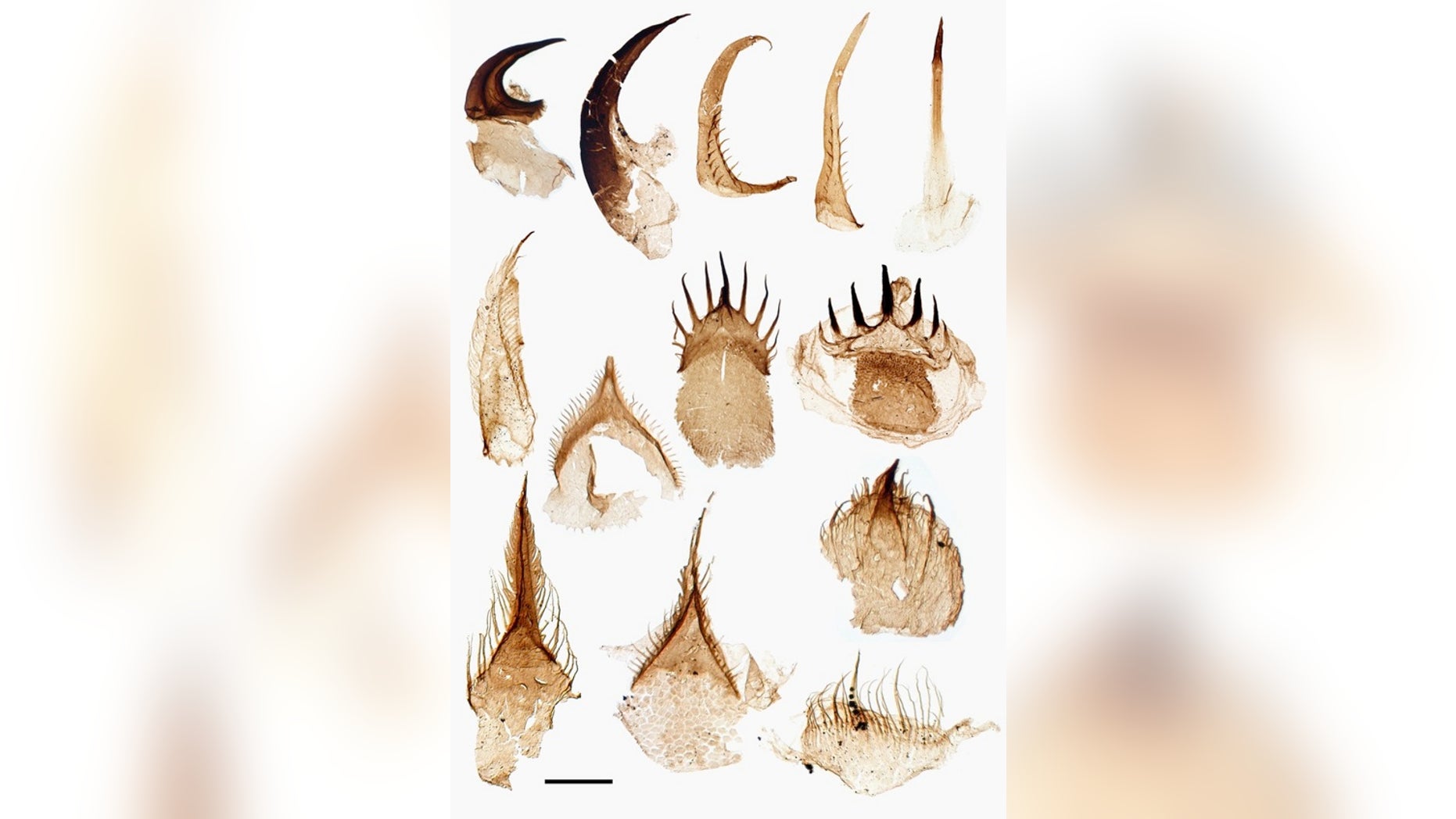 This is what the fossilized teeth of Ottoia prolifica look like under a microscope.