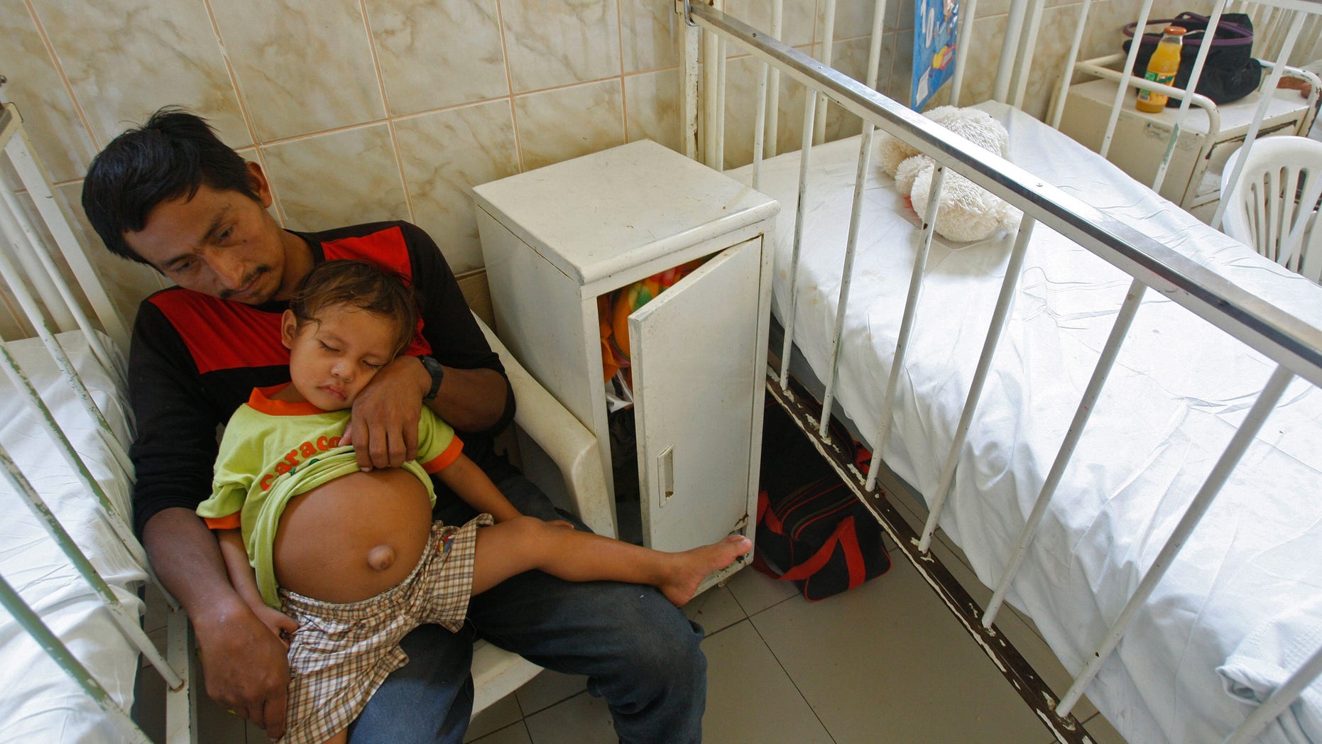 Leonidas Pacunda holds up the shirt of his son Isbac Pacunda, who was diagnosed with "Fetus in fetu" at Las Mercedes hospital in Chiclayo, Peru, Saturday Jan. 28, 2012. Isbac, 3, was diagnosed with having tissues from the fetus of his twin brother in his abdomen, called "Fetus in fetu," and will be operated on Monday, according to doctors. Fetus in fetu occurs once in every 500,000 live births, according pediatric surgeon Carlos Astocondor, who will lead the surgery with 12 other physicians. (AP Photo/Karel Navarro)