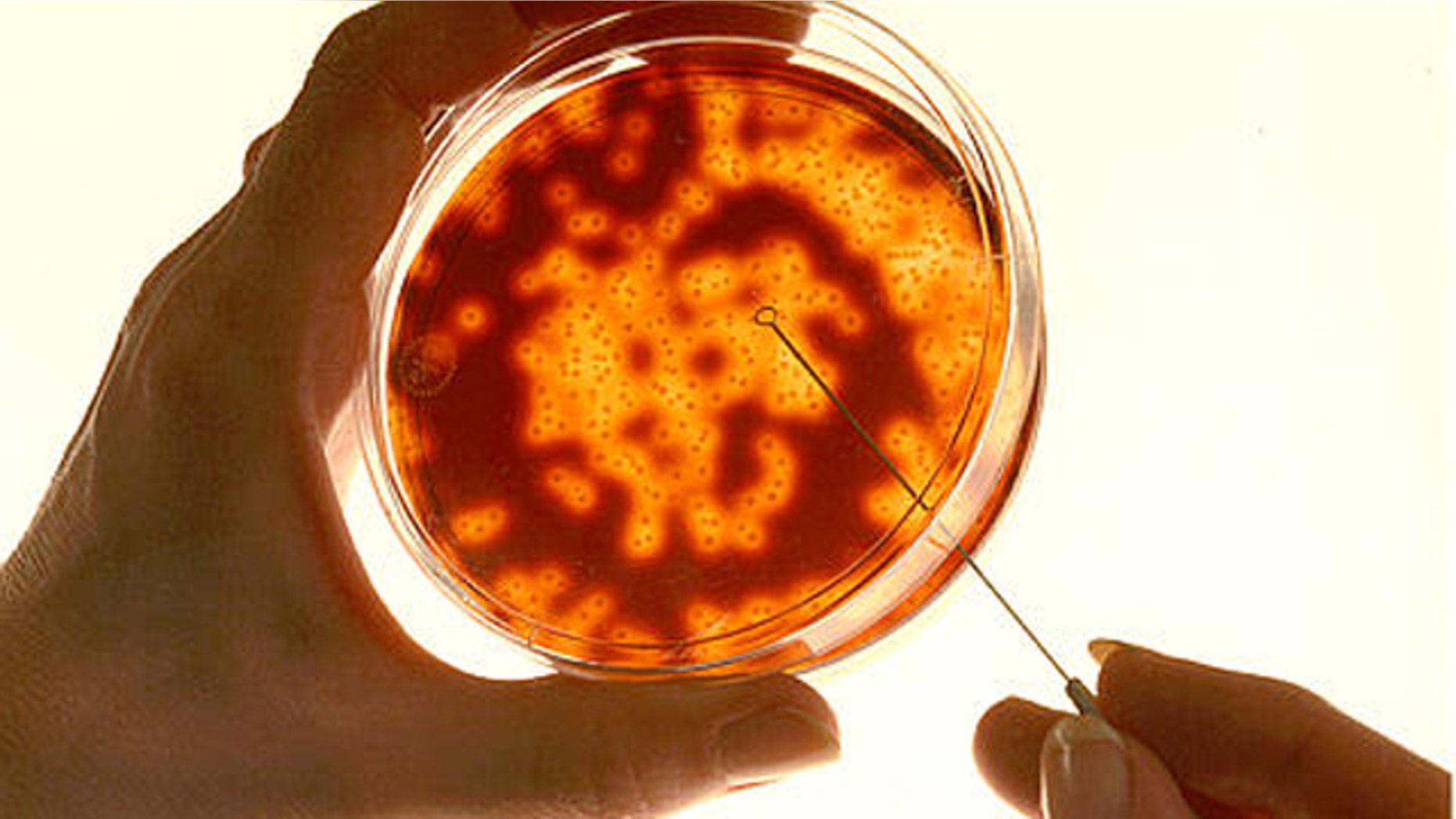 Growing meat in a laboratory ni a petri dish like this one may be the only way to boost the world's beef supplies, scientists said.