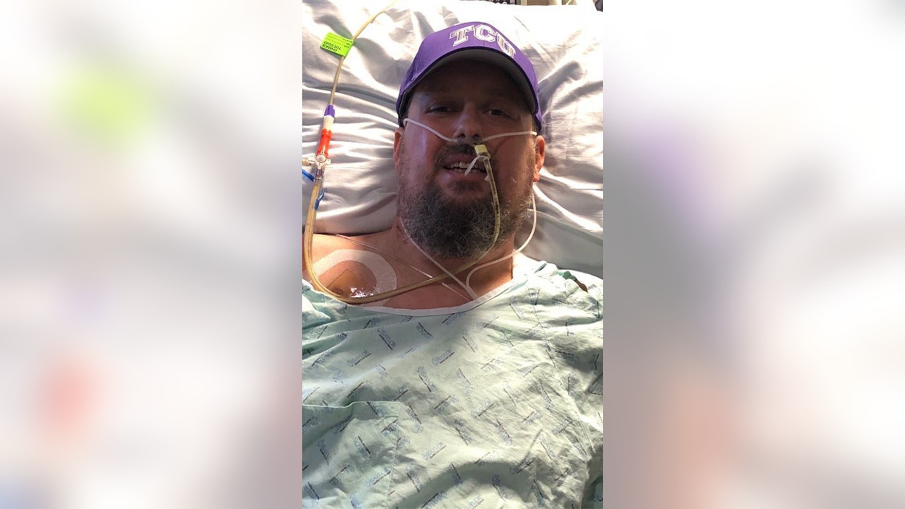 Brian Herndon wound up getting his two feet and nine fingers amputated after suffering severe complications from the flu.