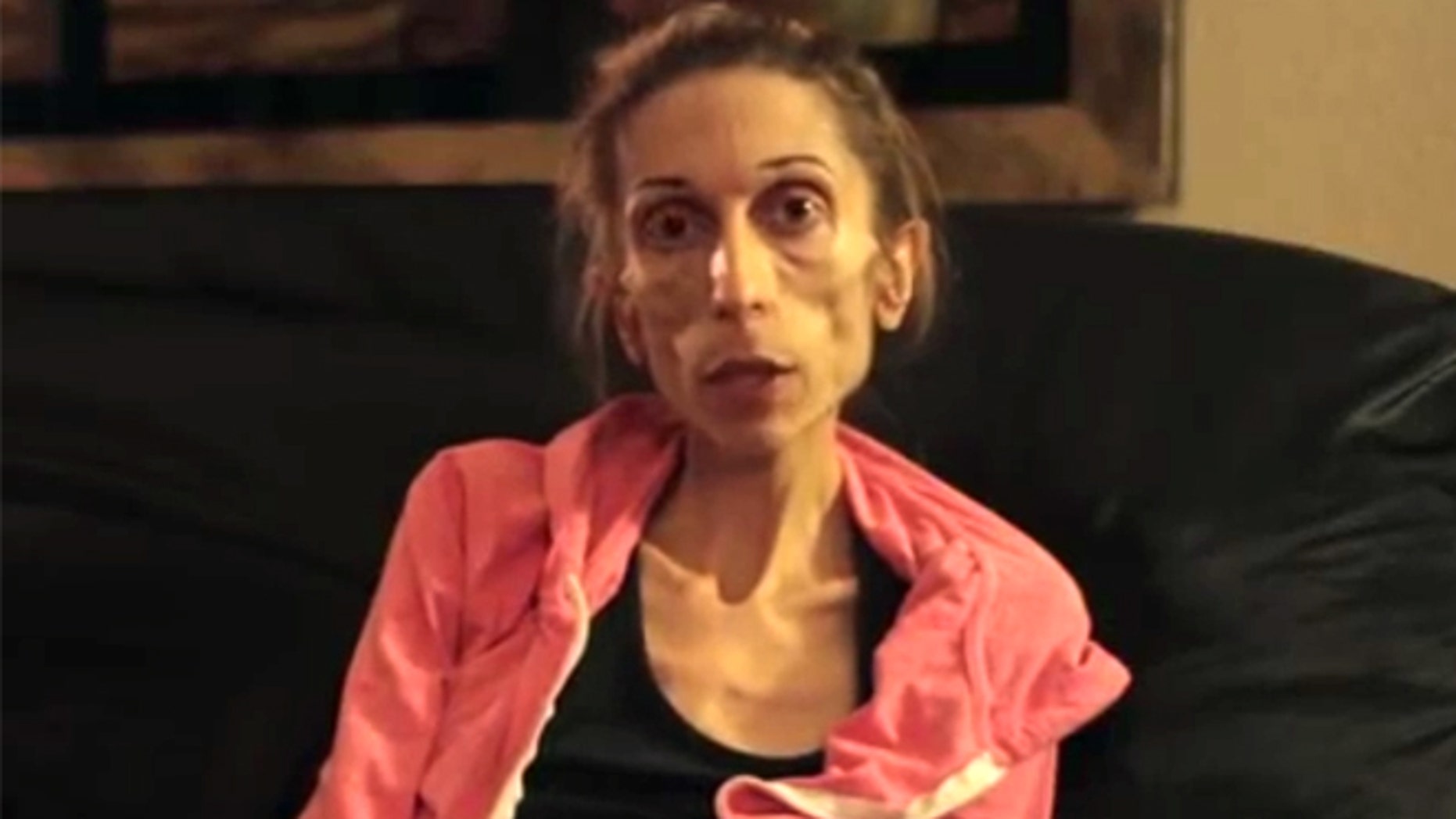 California Woman With Anorexia Makes Plea For Help On Youtube Fox News