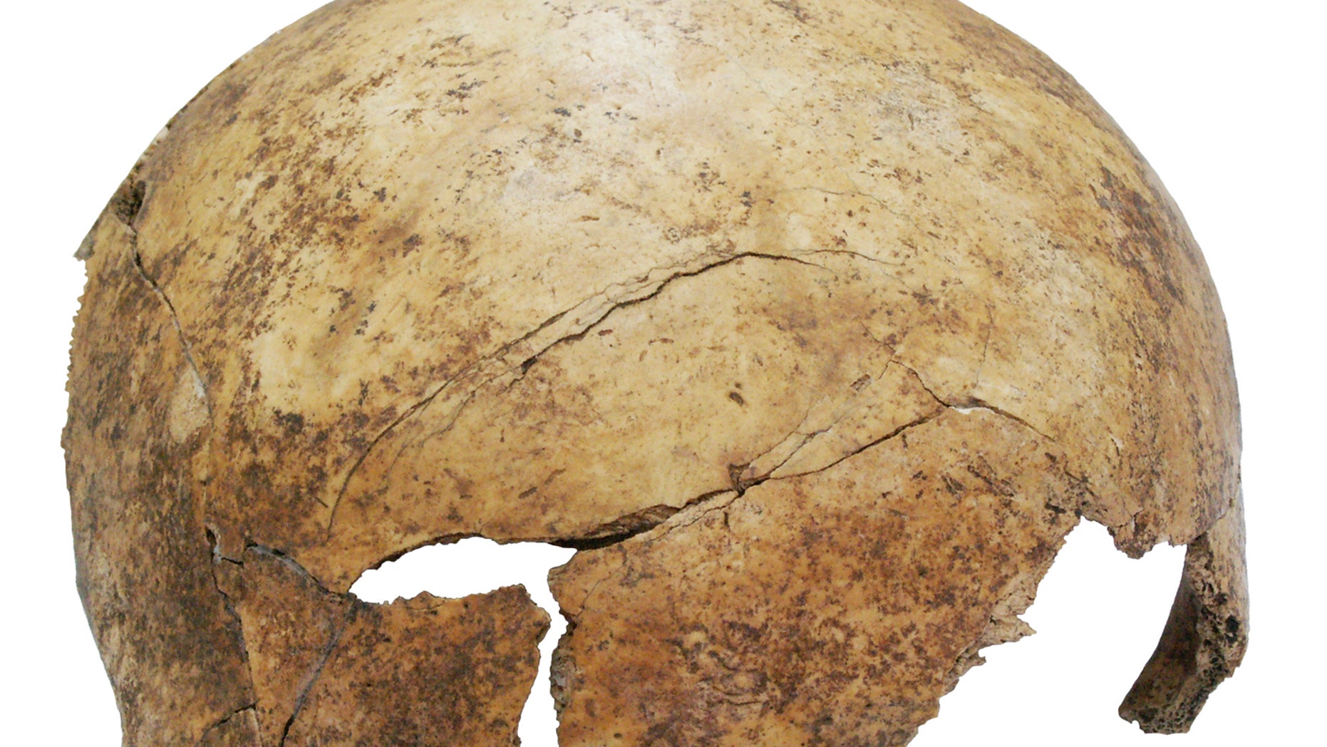 Photo released Monday Aug. 17, 2015 by researcher Christian Meyer shows the fractured skull of an about eight-years-old child with a digital mark to show the size.