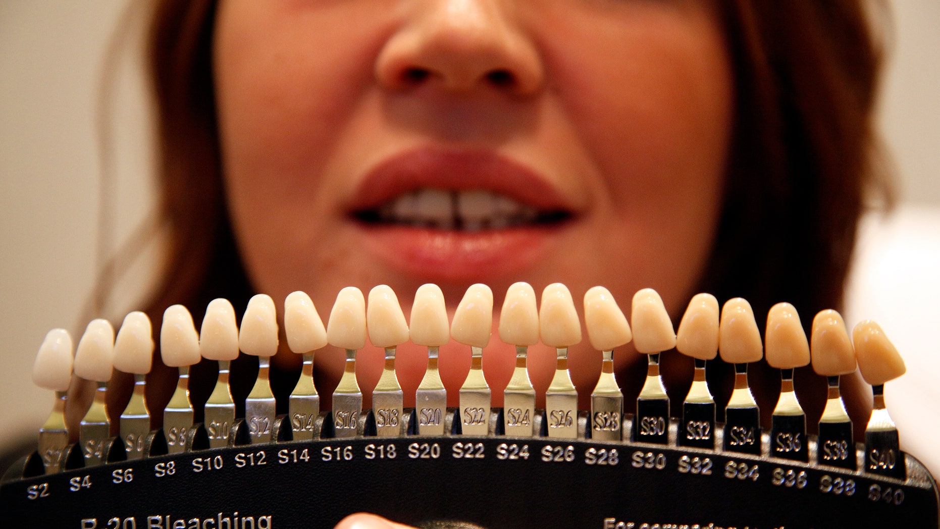 Teeth Whitening Colour Chart