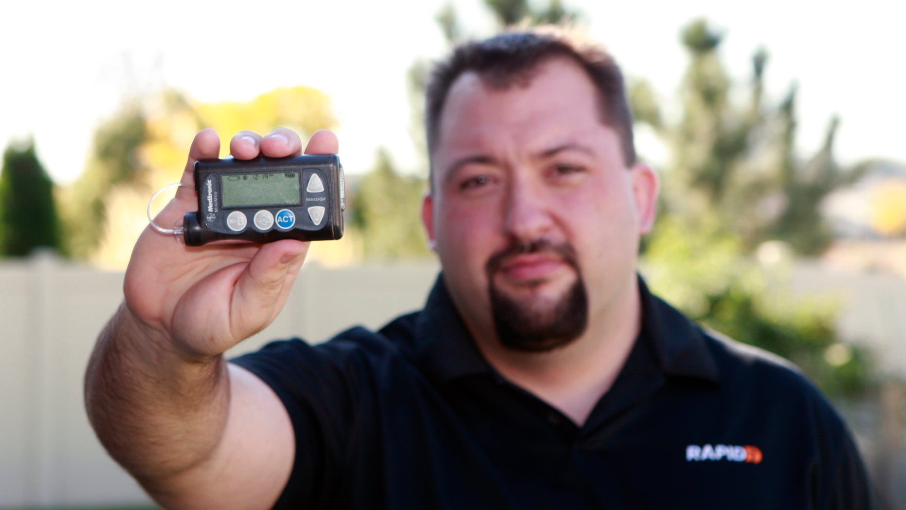 Jay Radcliffe shows off a Medtronic Corp insulin pump at his home in Meridian, Idaho.
