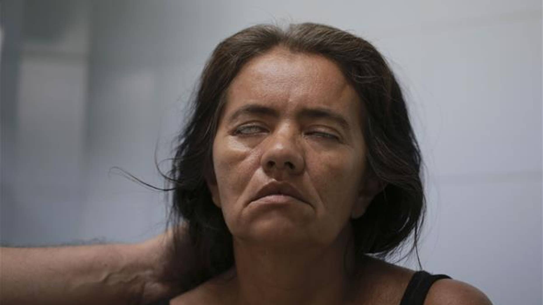 A patient fails to close her eyes as a neurologist tests her facial muscles at a hospital in Cucuta, Norte de Santander state, Colombia, on Feb. 11, 2016. The woman was diagnosed with Guillain-Barre syndrome.
