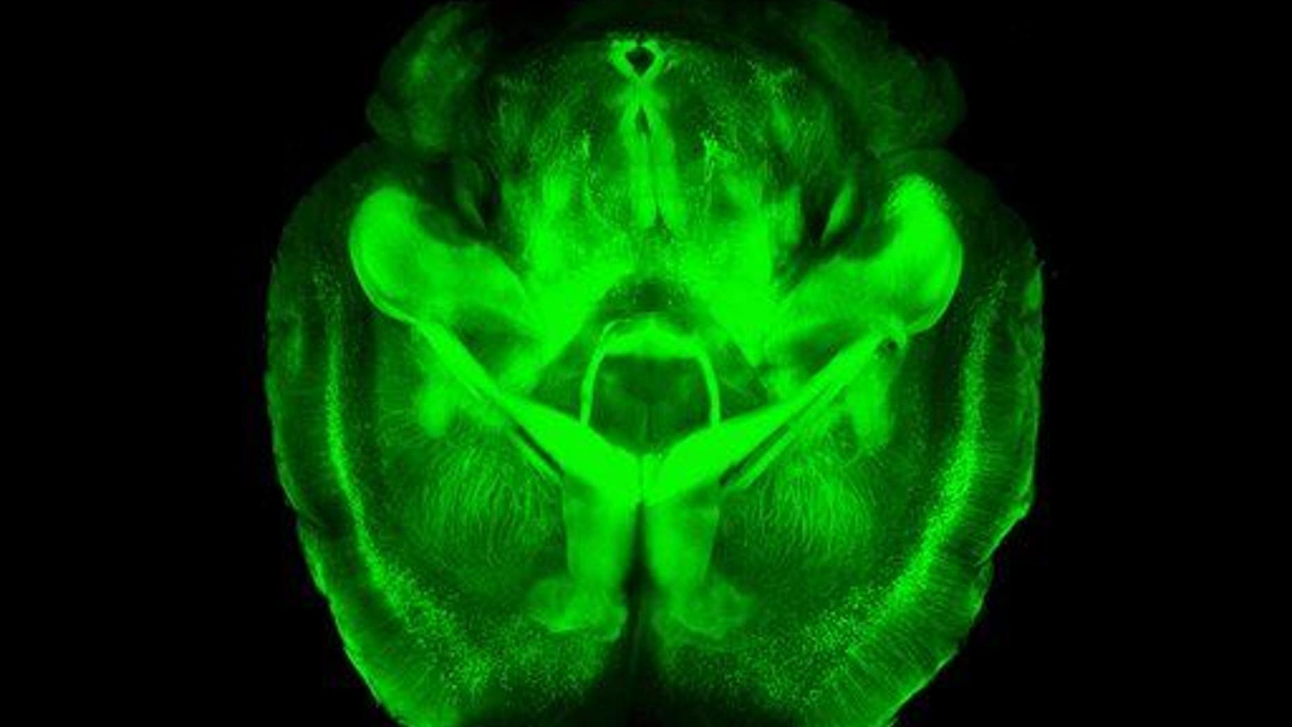 This undated image provided by Karl Deisseroth's lab shows a three-dimensional rendering of clarified mouse brain seen from below.