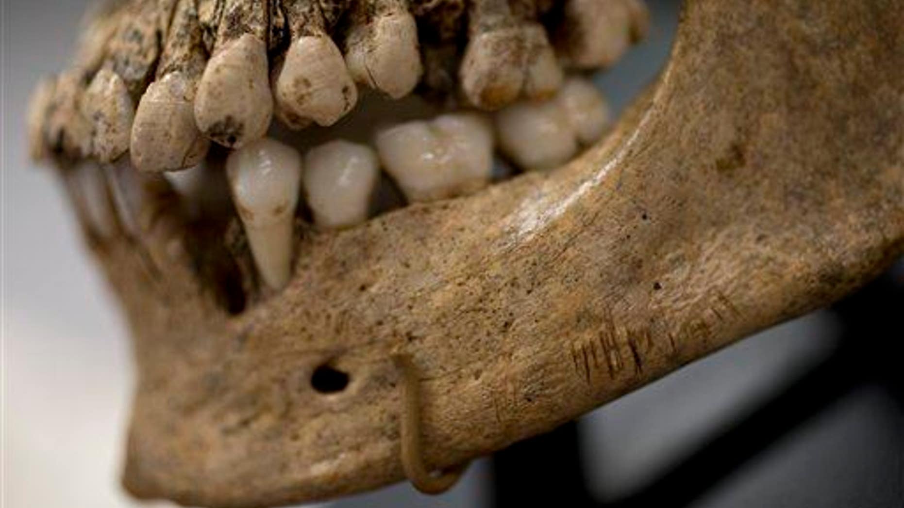 Numerous small knife cuts and punctures in the mandible of "Jane of Jamestown" are seen during a news conference at the Smithsonian's National Museum of Natural History in Washington, May 1, 2013.