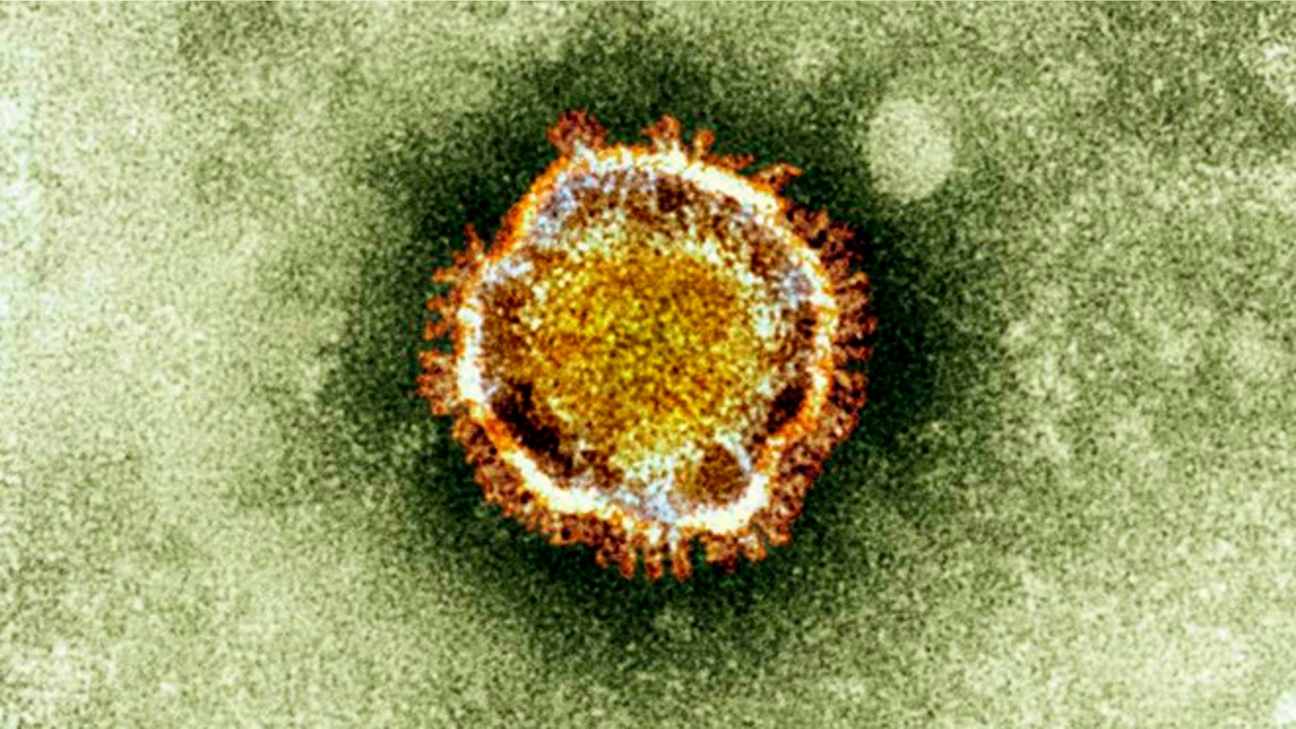 Electron microscope image of a coronavirus, part of a family of viruses that cause ailments including the common cold and SARS.