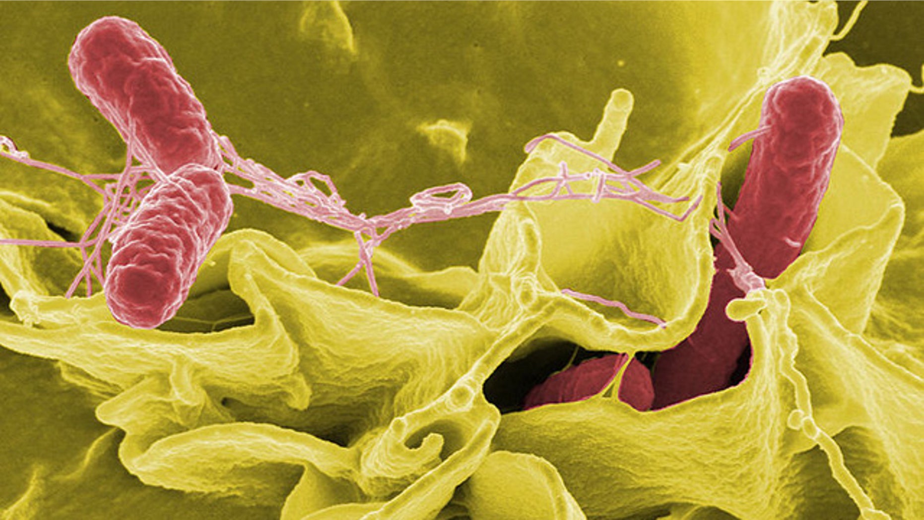 Color-enhanced scanning electron micrograph showing Salmonella typhimurium (red) invading cultured human cells.