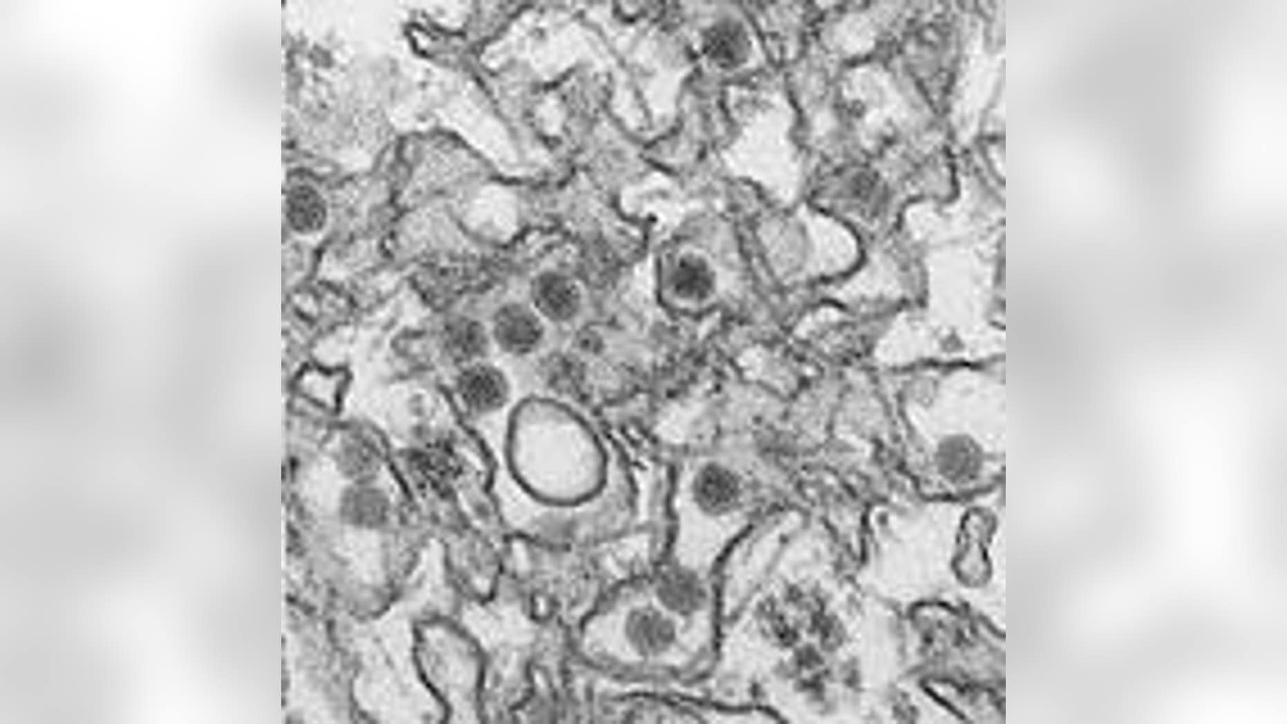 This image provided by the CDC shows the Zika virus.