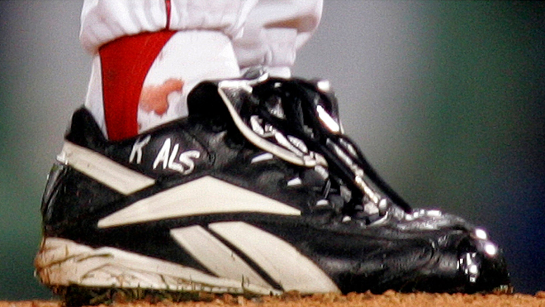 Oct. 24, 2004: This file photo shows blood around the ankle of Boston Red Sox pitcher Curt Schilling during the first inning of Game 2 of the World Series in Boston.