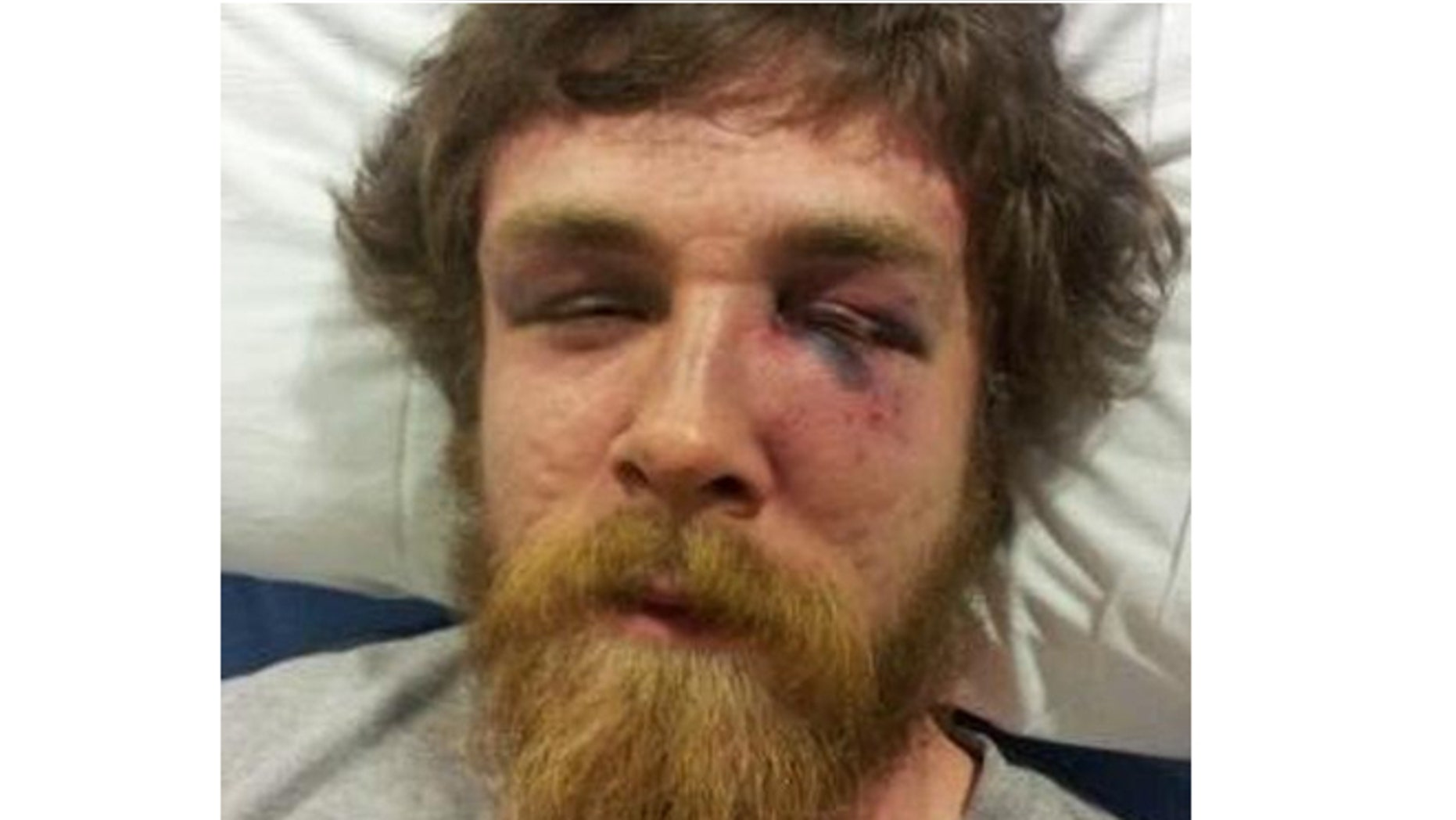 Sean Kedzie in his hospital bed shortly after the beating incident in Whitewater, Wisconsin.