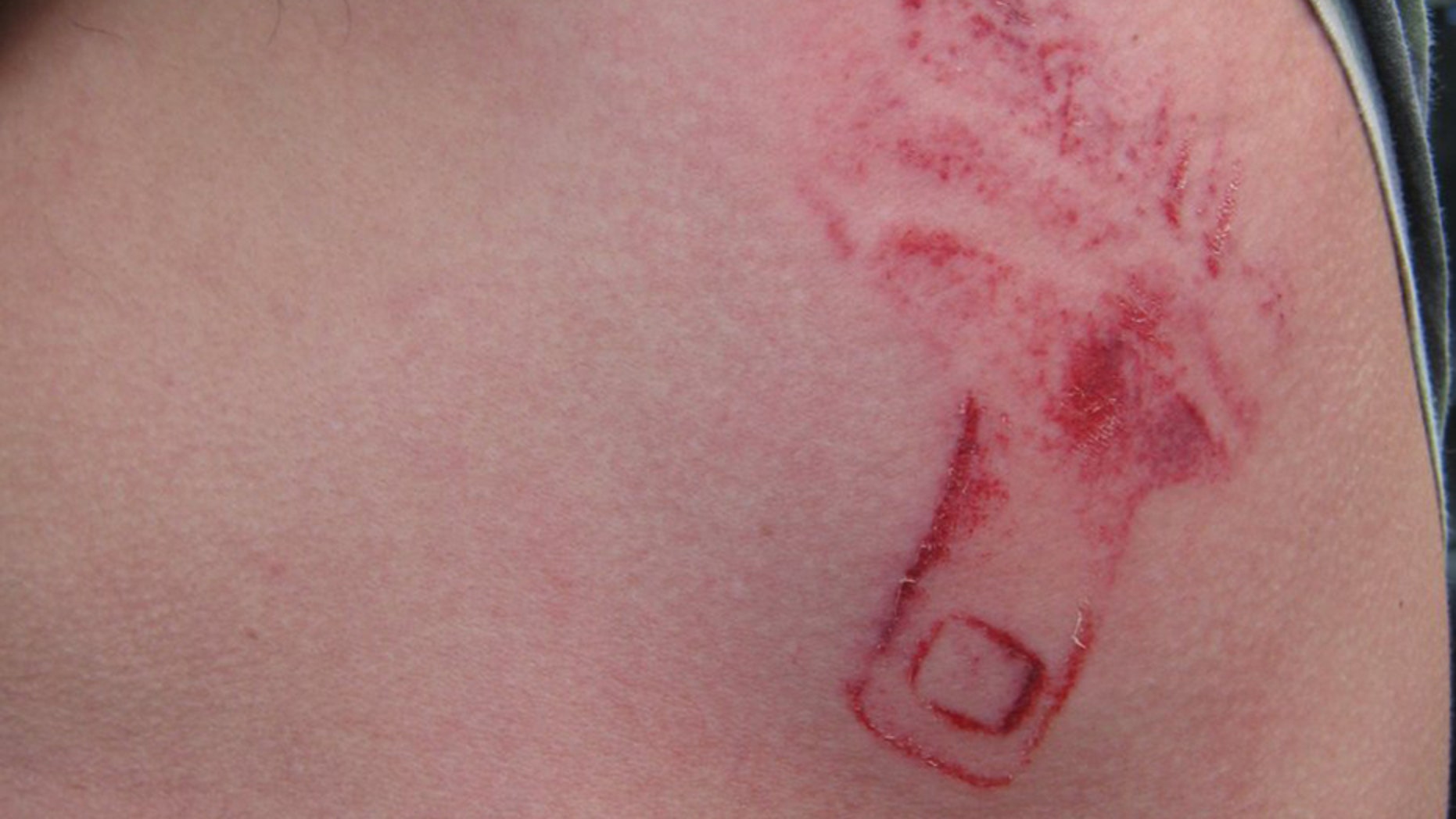 Washington state authorities shared a photo Wednesday of a man’s unexpected car crash wound, taking the moment to stress the need for people to wear seatbelts.