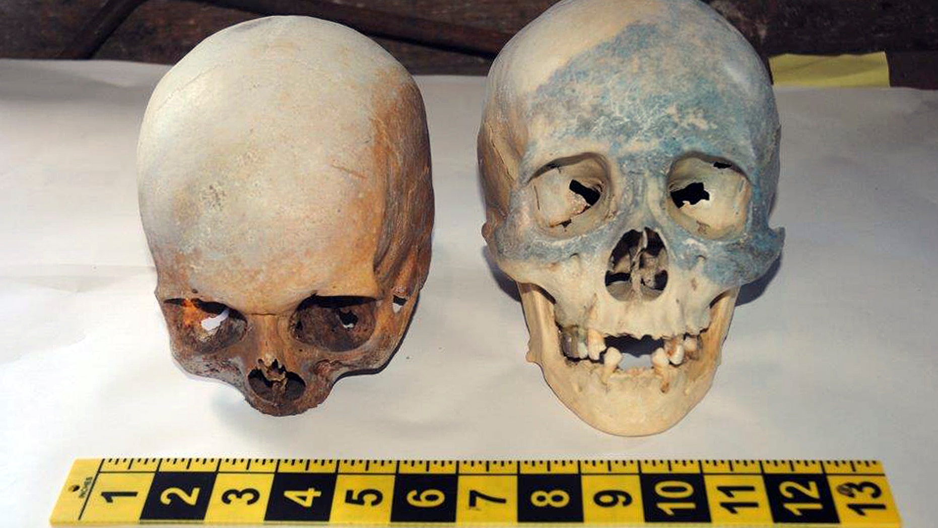 In this photo released by the Stamford, Conn., Police Department Friday, Oct. 31, 2014, two human skull are displayed, which were found at the Stamford Refuge Transfer Station. (AP/Stamford Police Department)